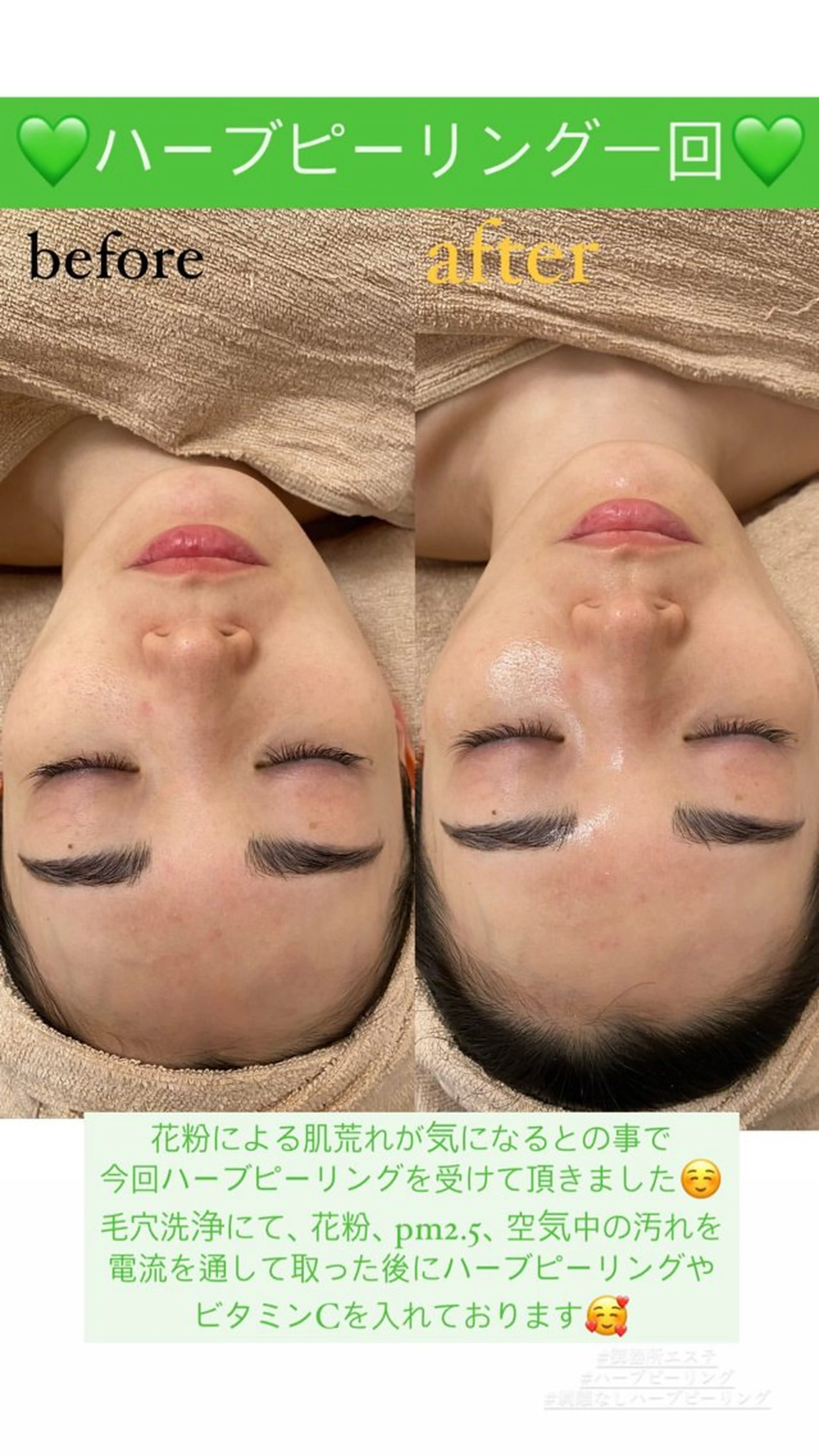 メンズ エステ Salon de Lino 御器所のエステ・リラクイメージ