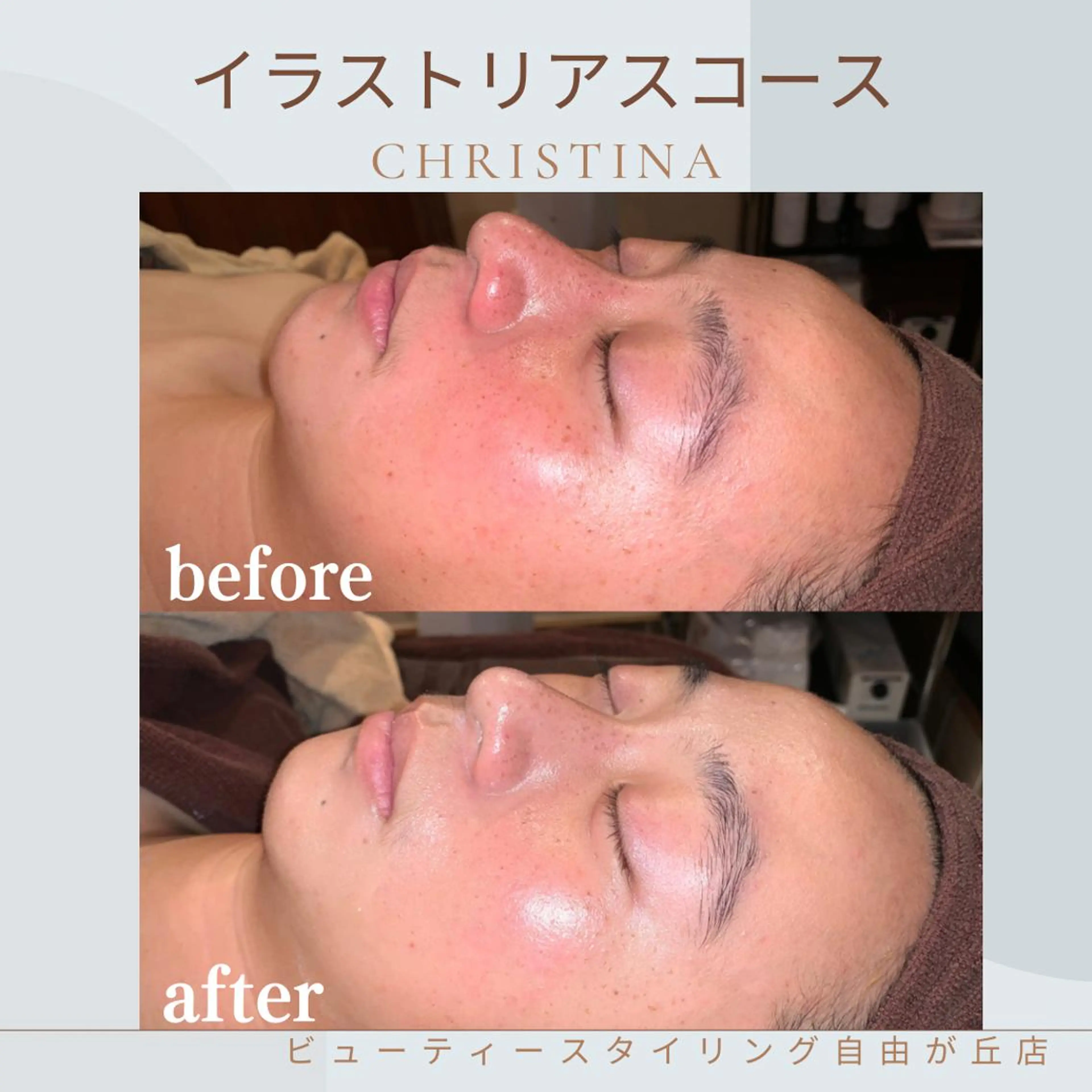 【クリスティーナ】イラストリアス🥚徹底美白✨の写真