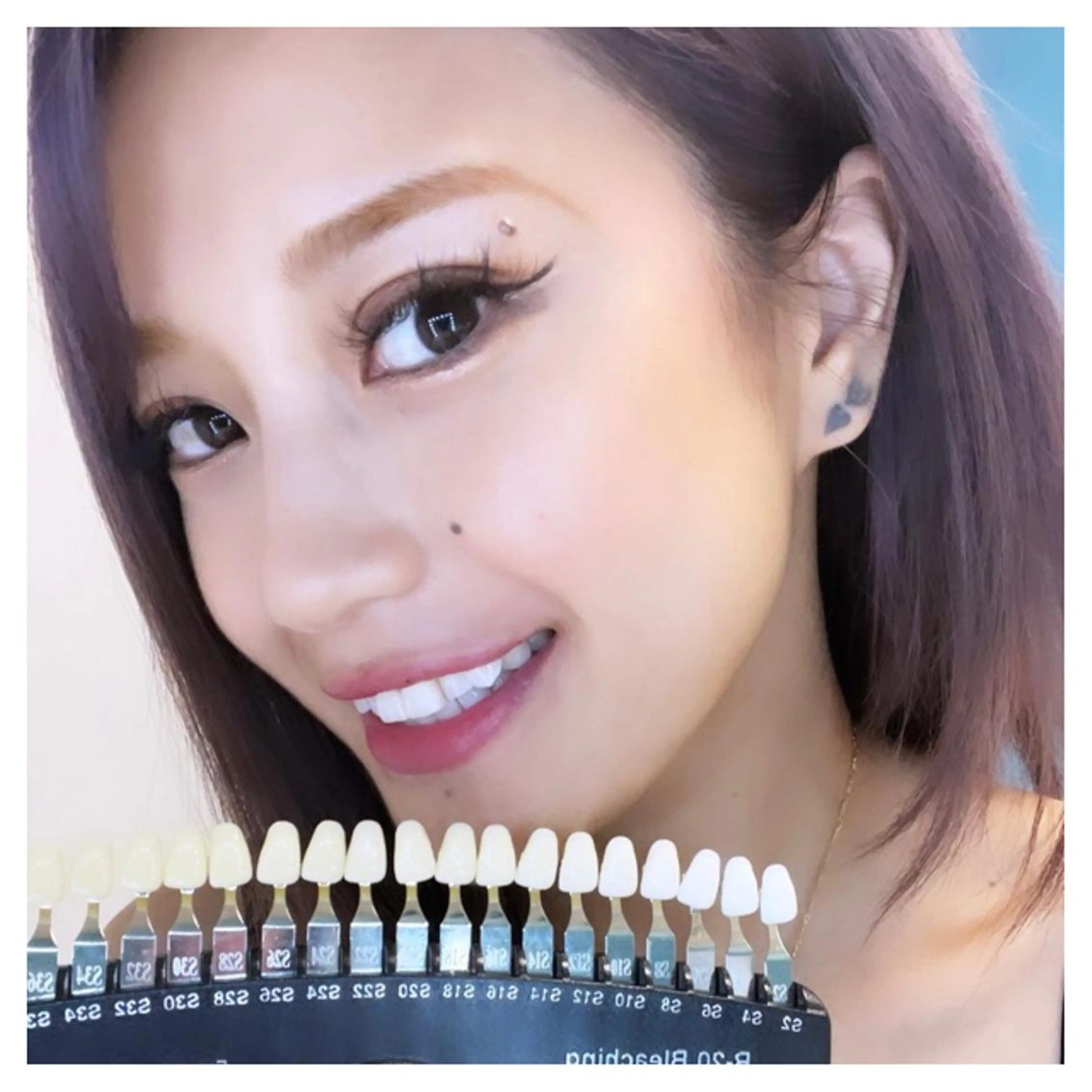 PLATINUM Beauty 横浜店所属・ホワイトニングルーム 横浜店のその他イメージ