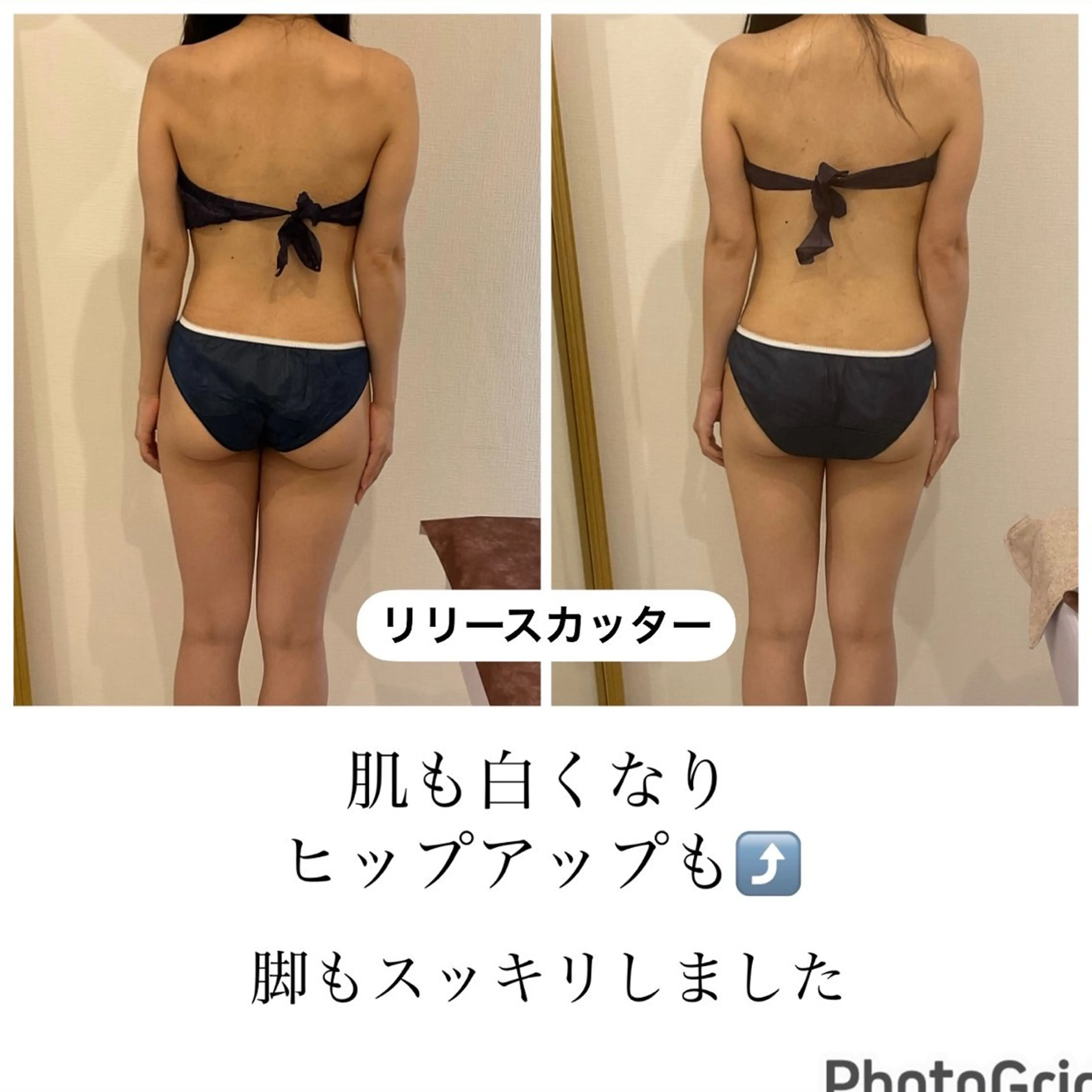 エステ リラク 美容筋膜リリースサロンGLOW BOX所属・GLOW BOXのエステ・リラクイメージ