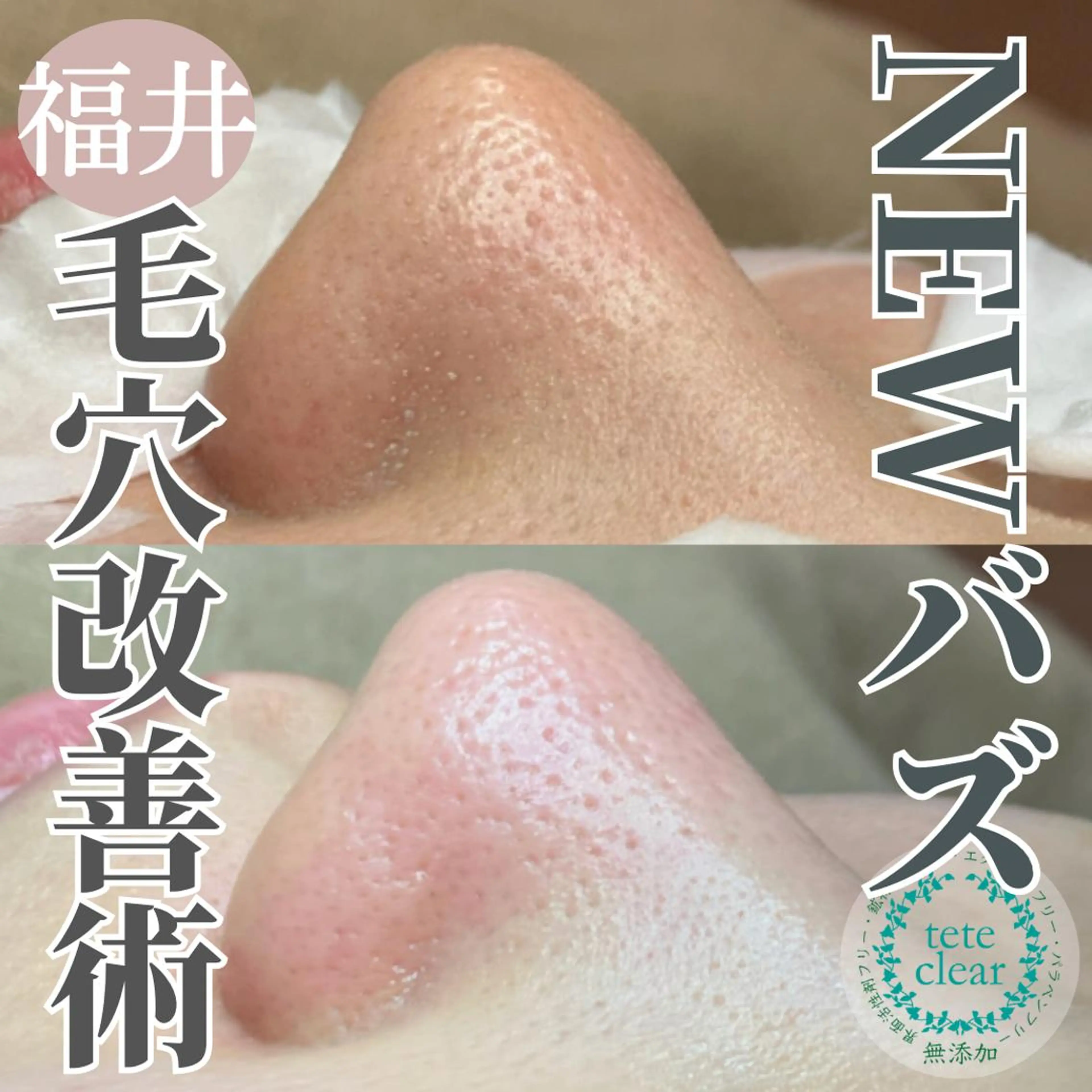 毛穴肌質ケアサロン Yourmeユアミーのエステ・リラクイメージ