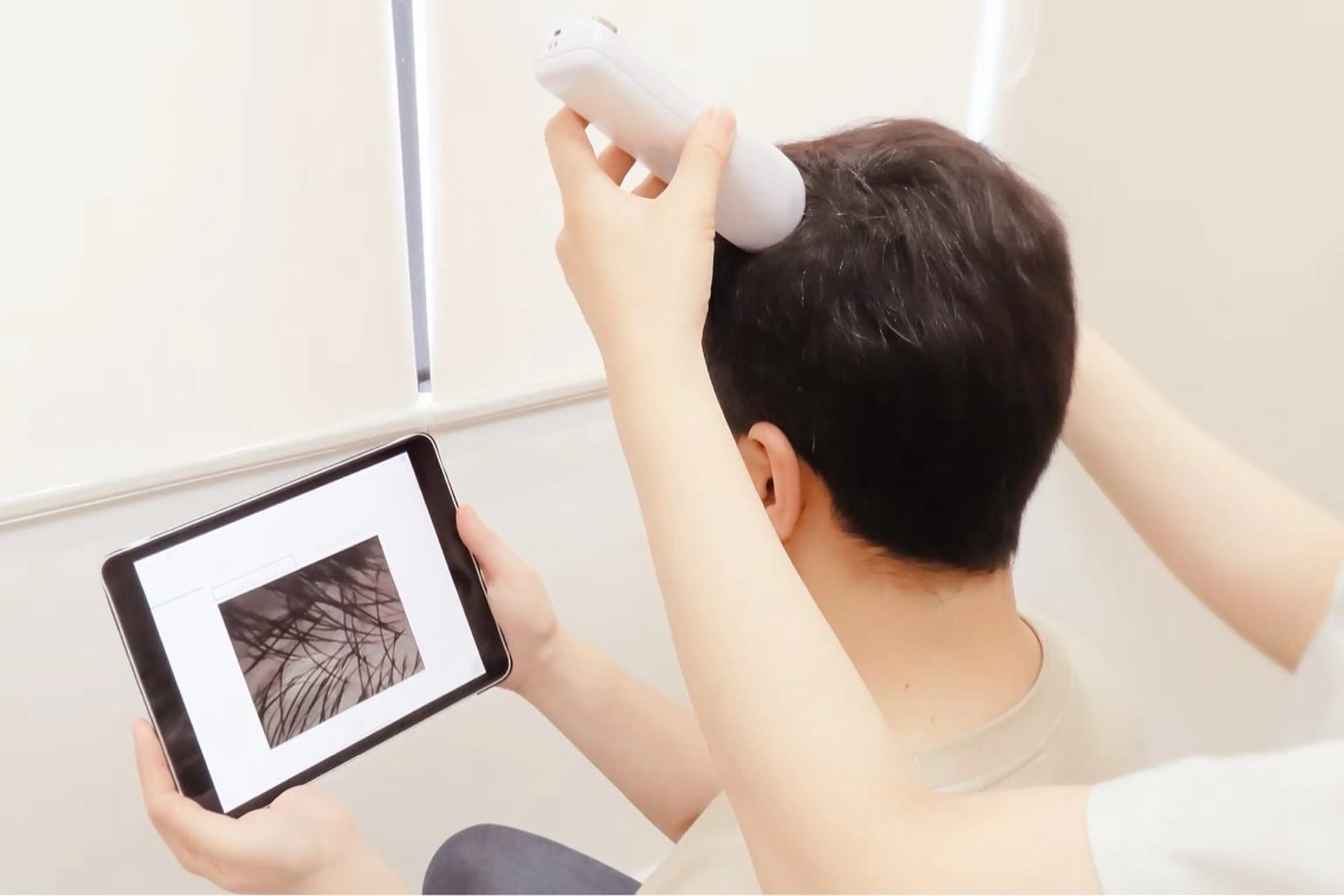 【男性女性年齢問わず】マイクロスコープ頭皮診断 無料の写真