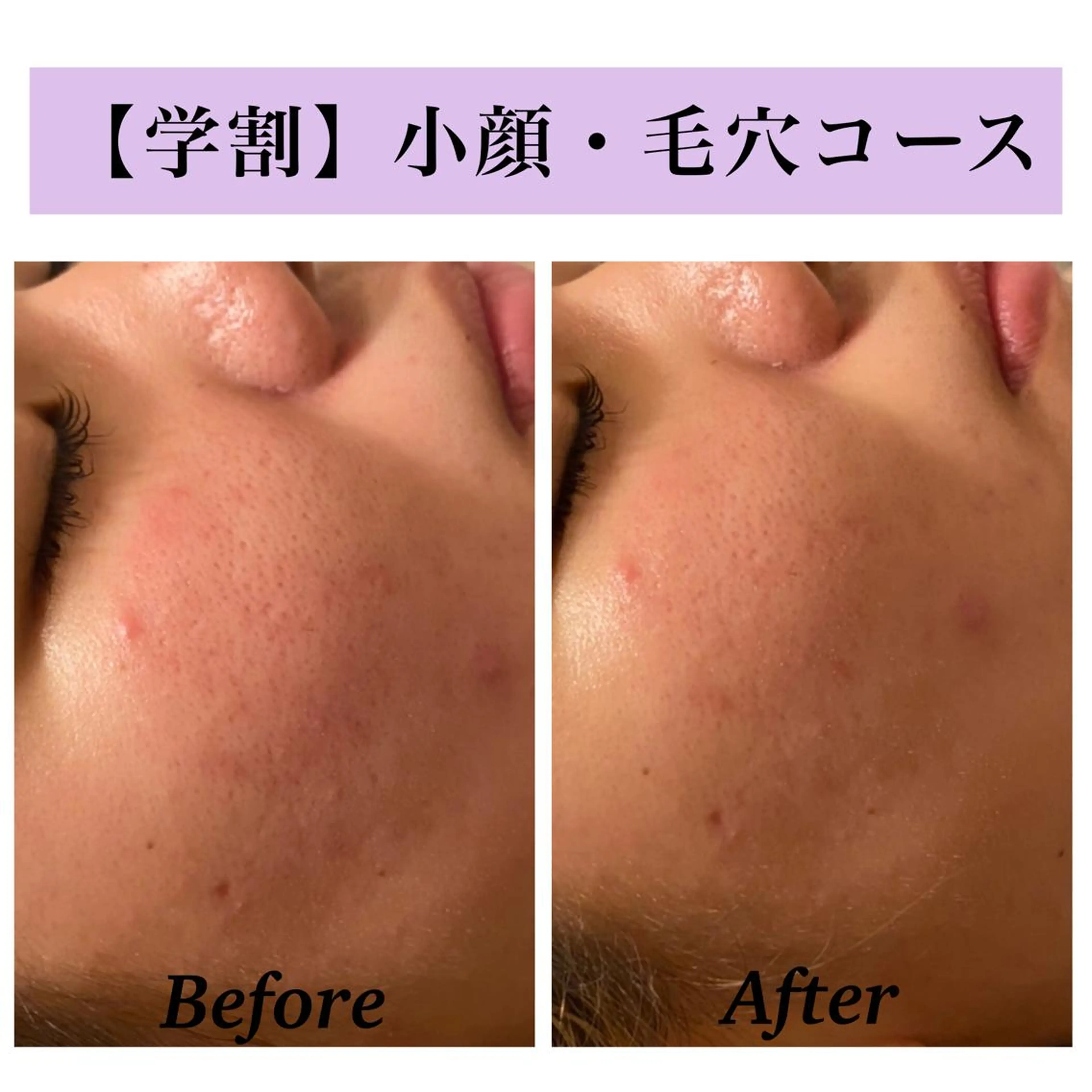 Bellesthe （ベルエステ）のエステ・リラクイメージ