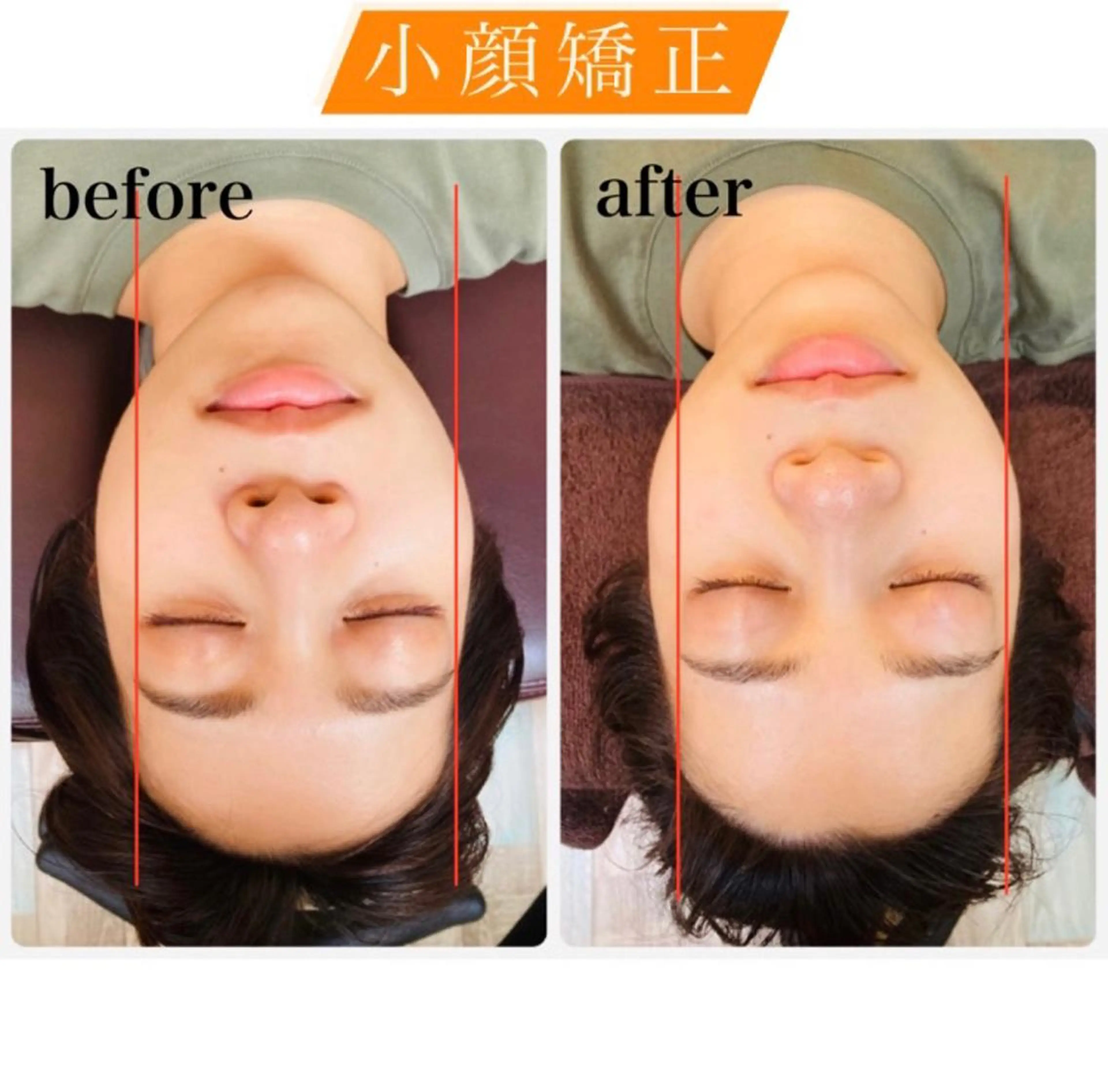 エステ リラク EXTR エクスターのエステ・リラクイメージ