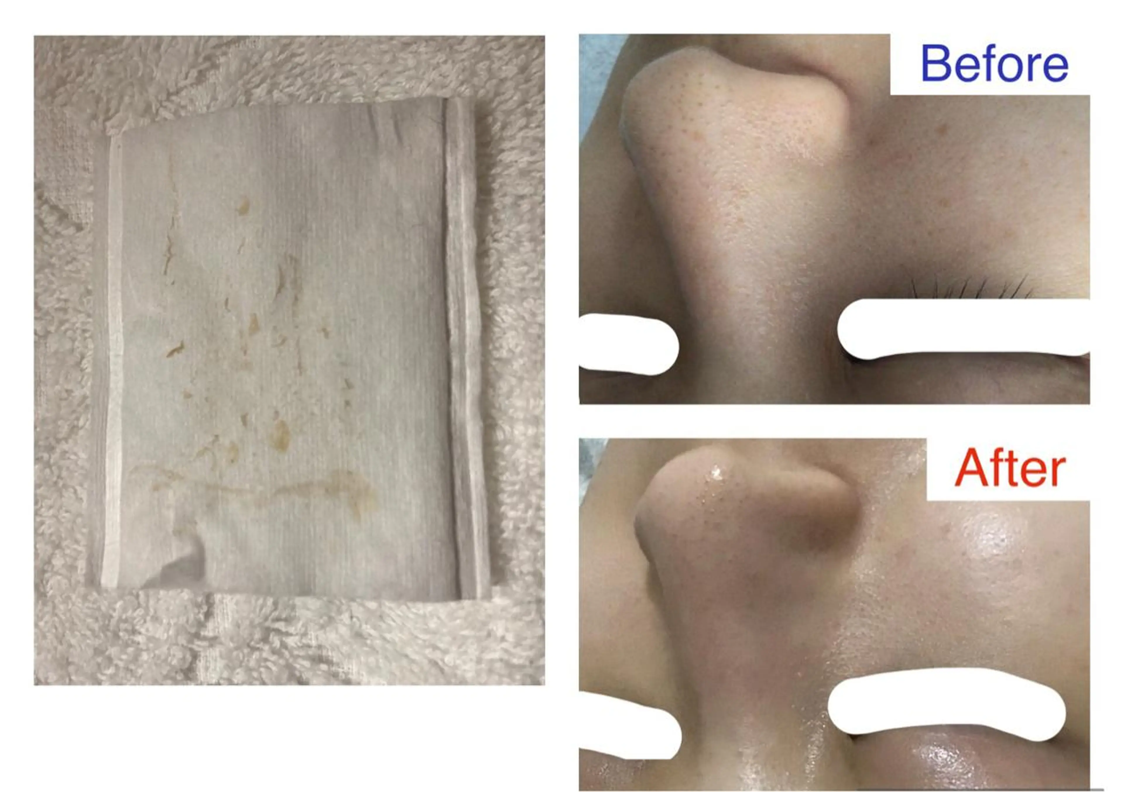 子宮矯正/腸揉み/ シュガーリング脱毛のエステ・リラクイメージ