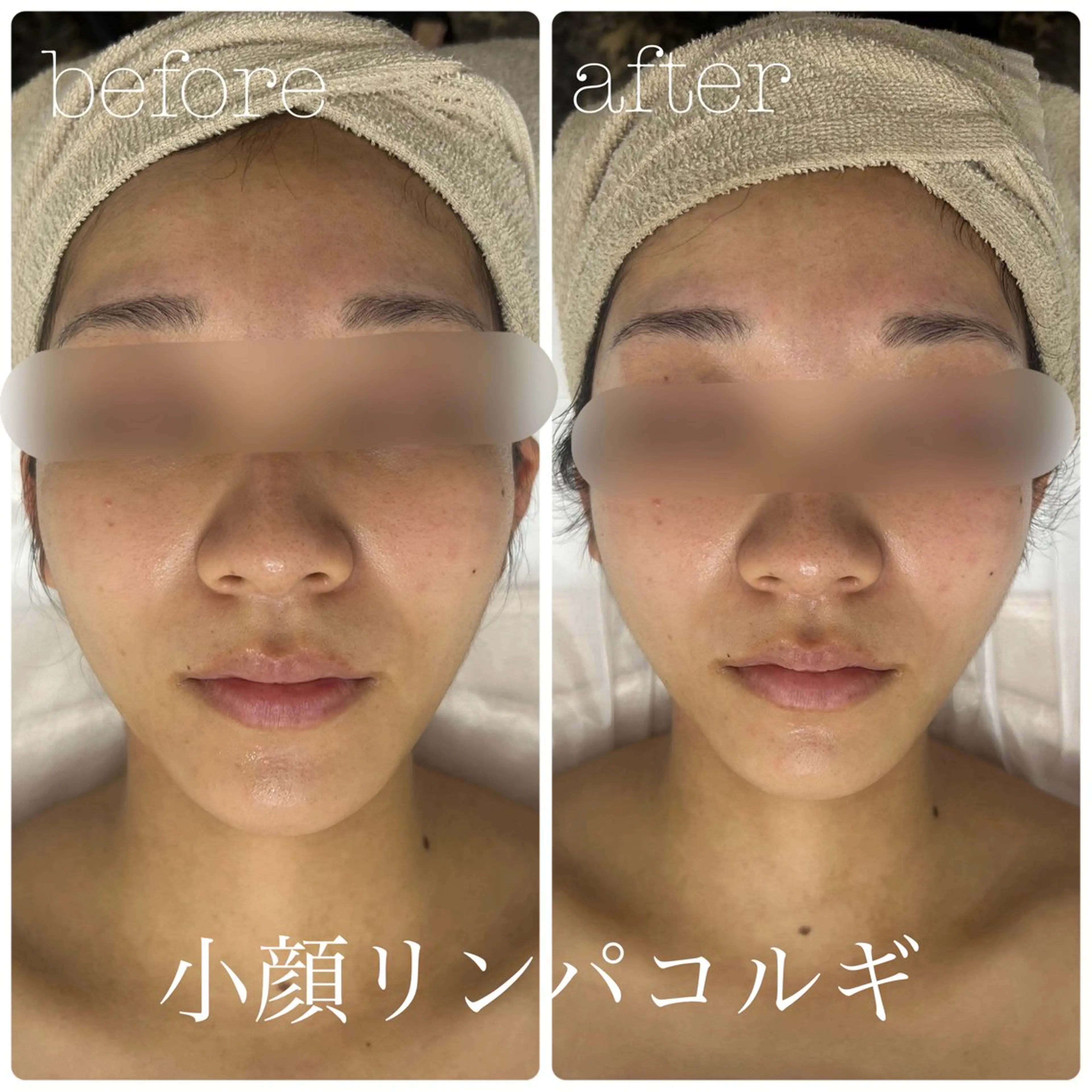 メンズ フェイシャルサロン CHIARA 荒田のエステ・リラクイメージ