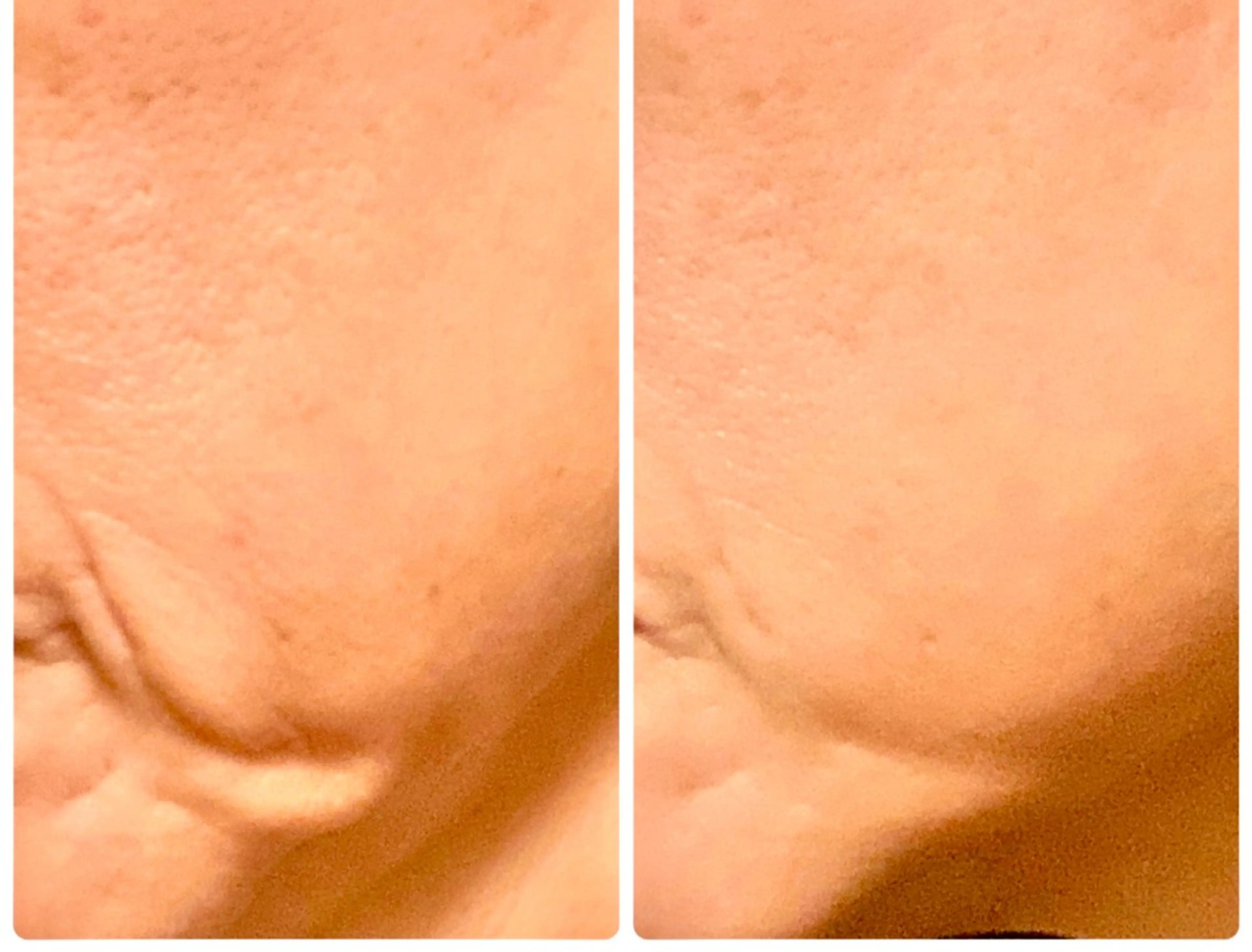 エステ terhibur 〜テルヒブール〜のエステ・リラクイメージ