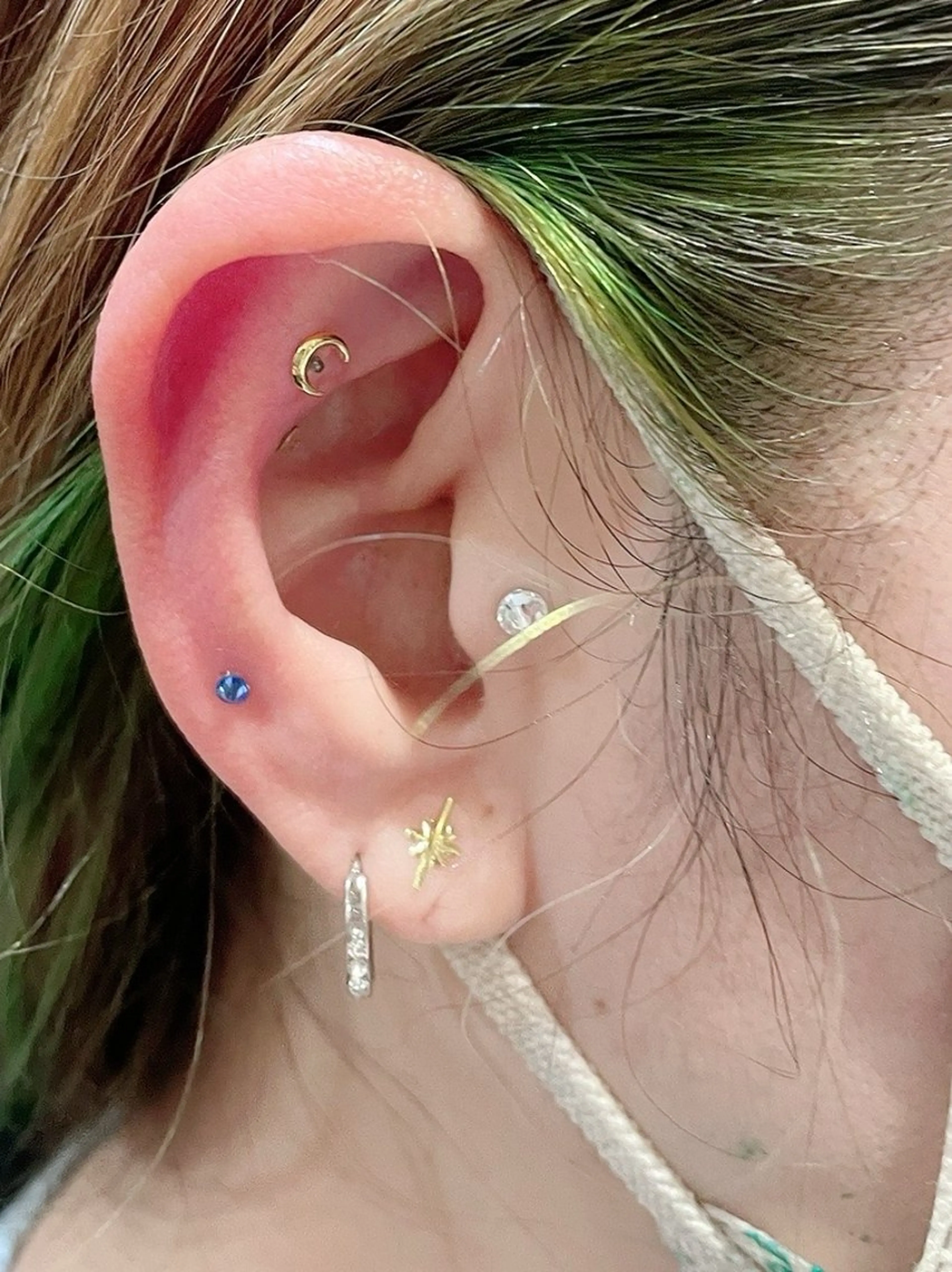 エステ リラク 痛くないシミ取り 【荻窪】石橋のヘアスタイル