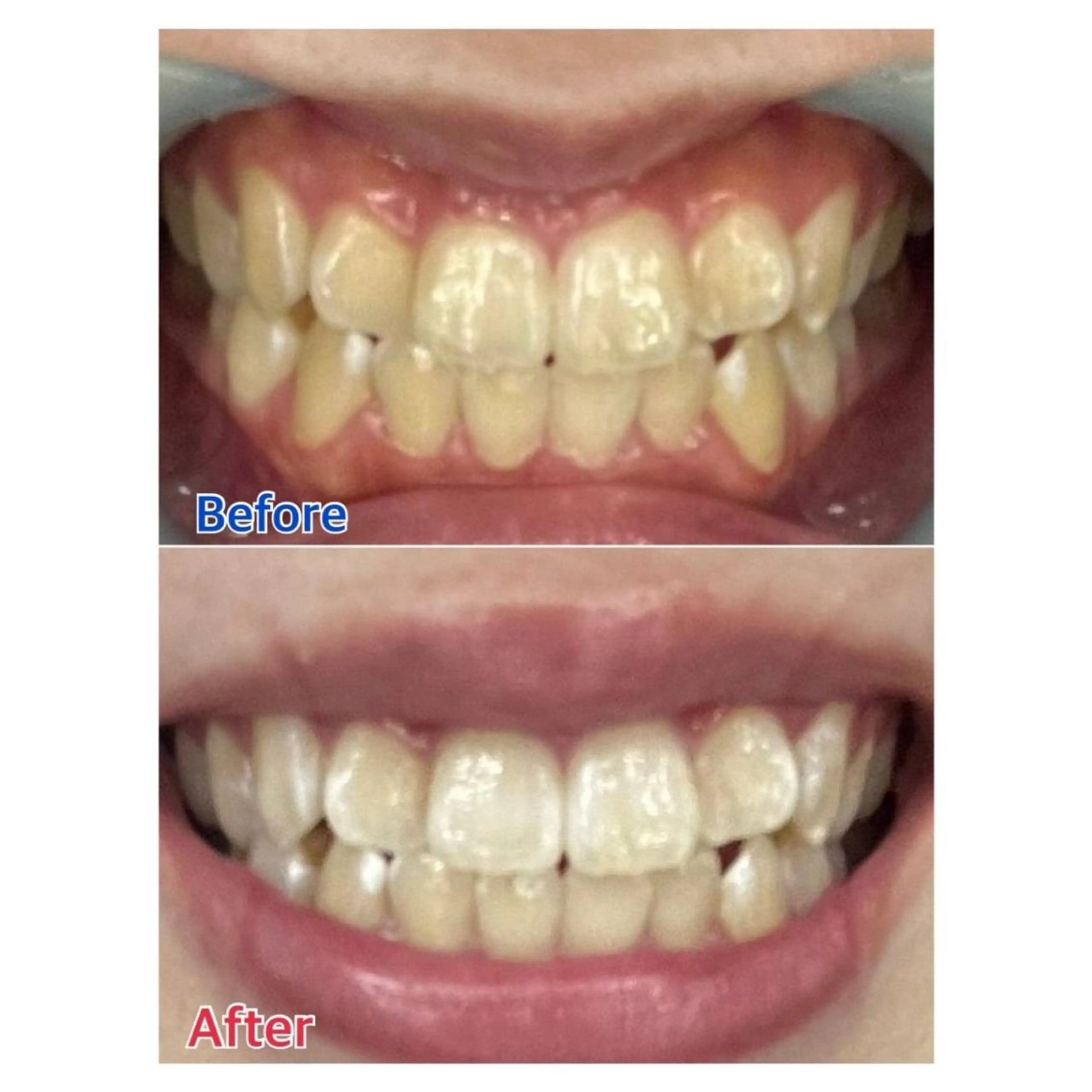 Melty 輝のその他イメージ