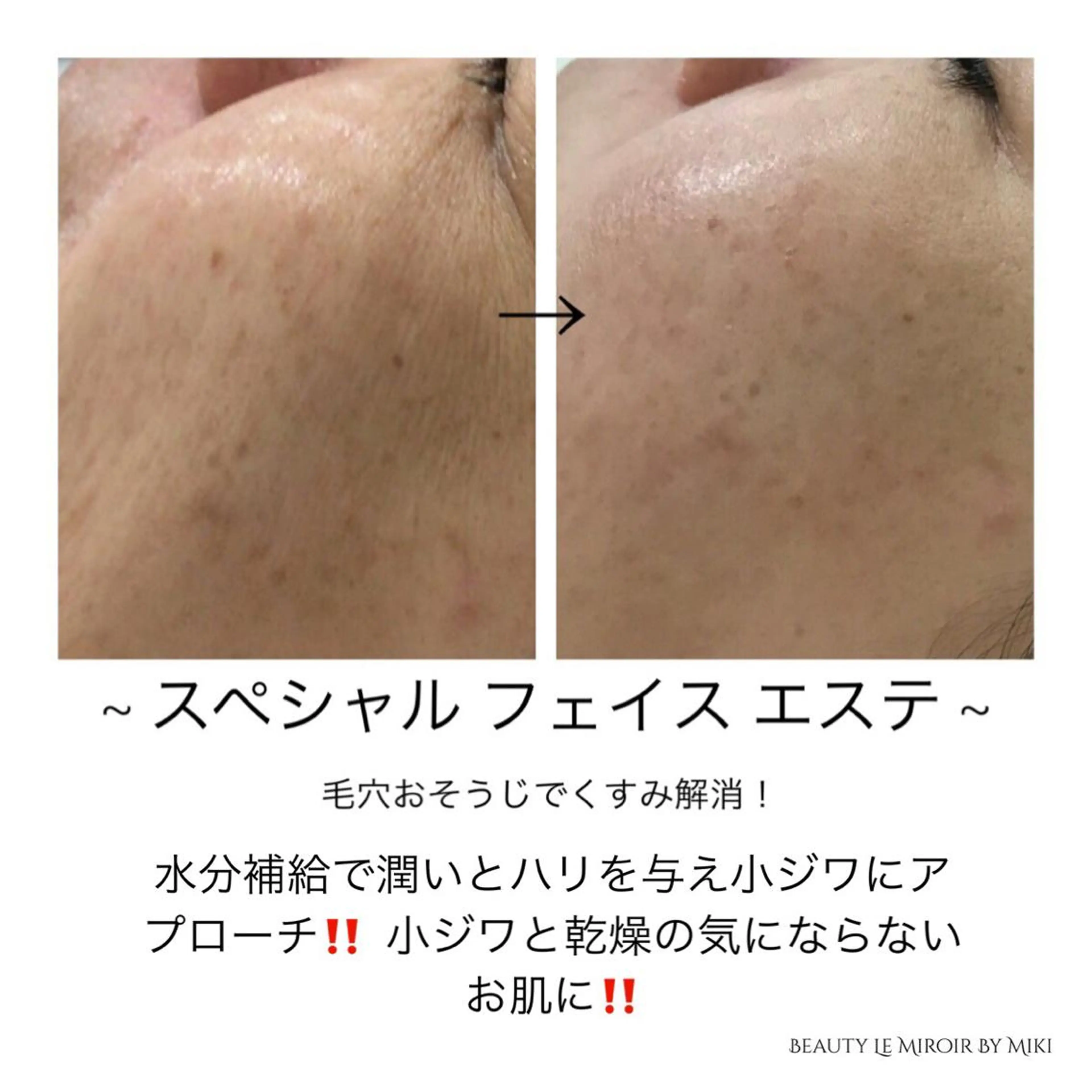 ビューティー ミロワールのエステ・リラクイメージ