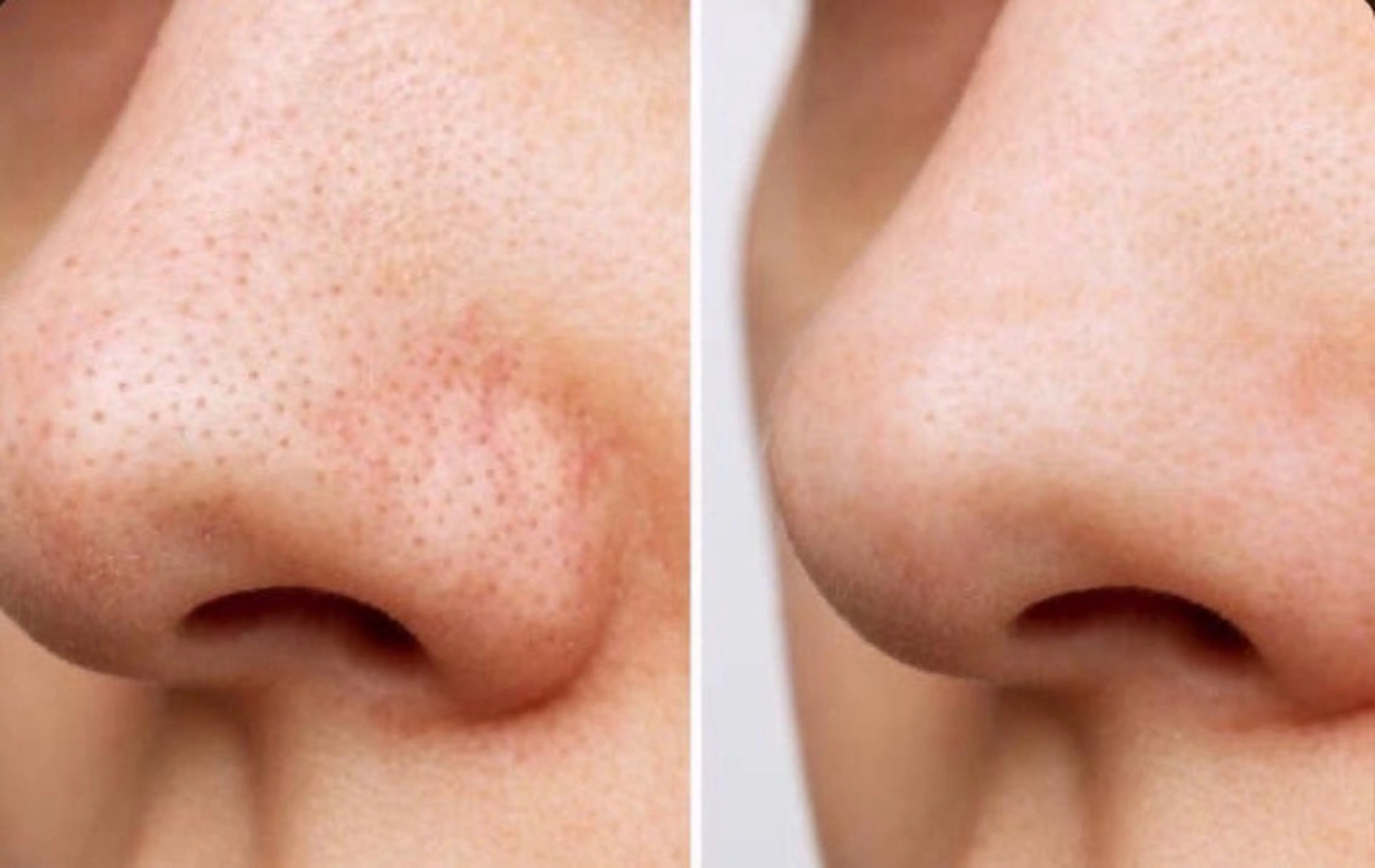 高田馬場店 /ゆづのヘアスタイル