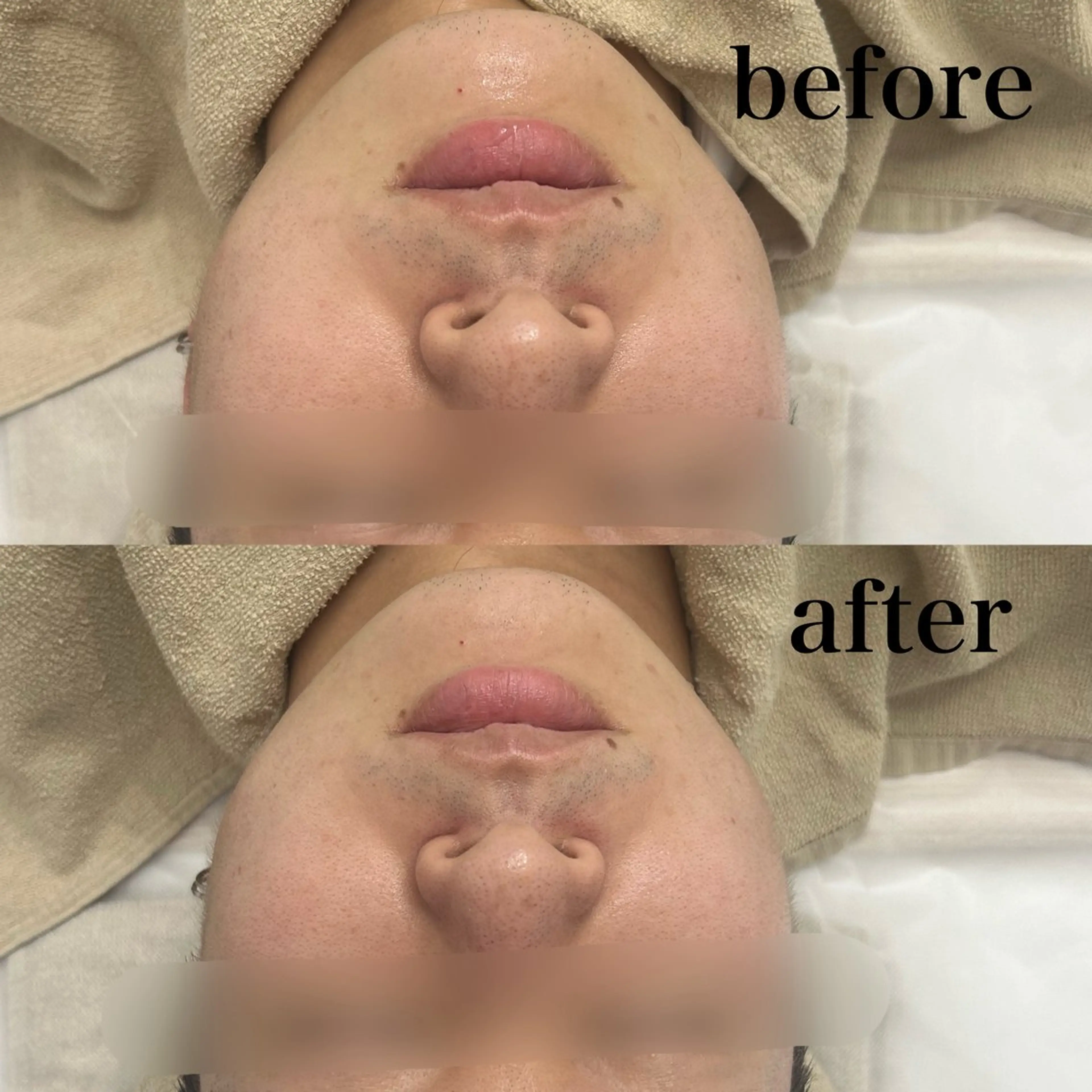 エステ フェイシャルサロン CHIARA 荒田のエステ・リラクイメージ