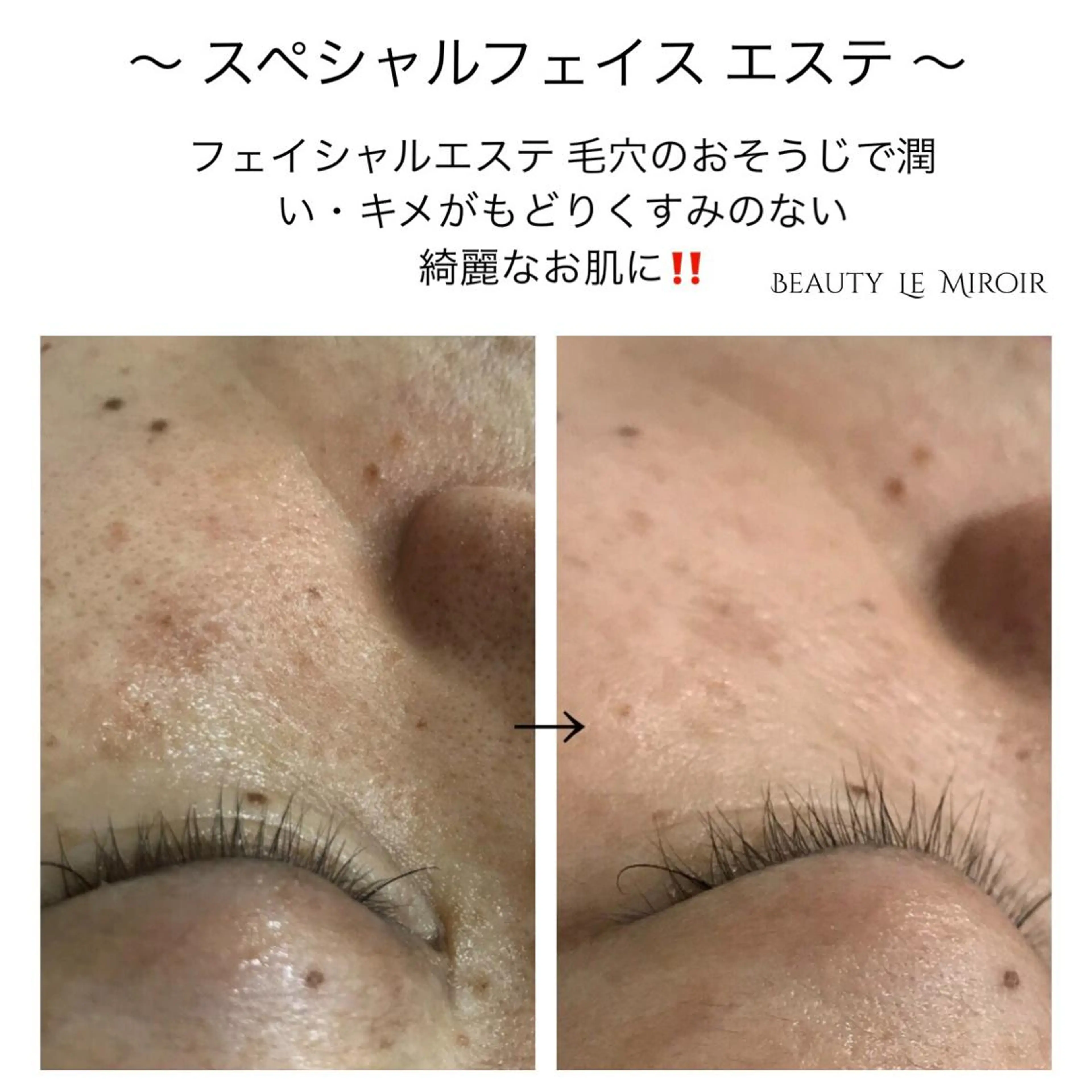 ビューティー ミロワールのエステ・リラクイメージ