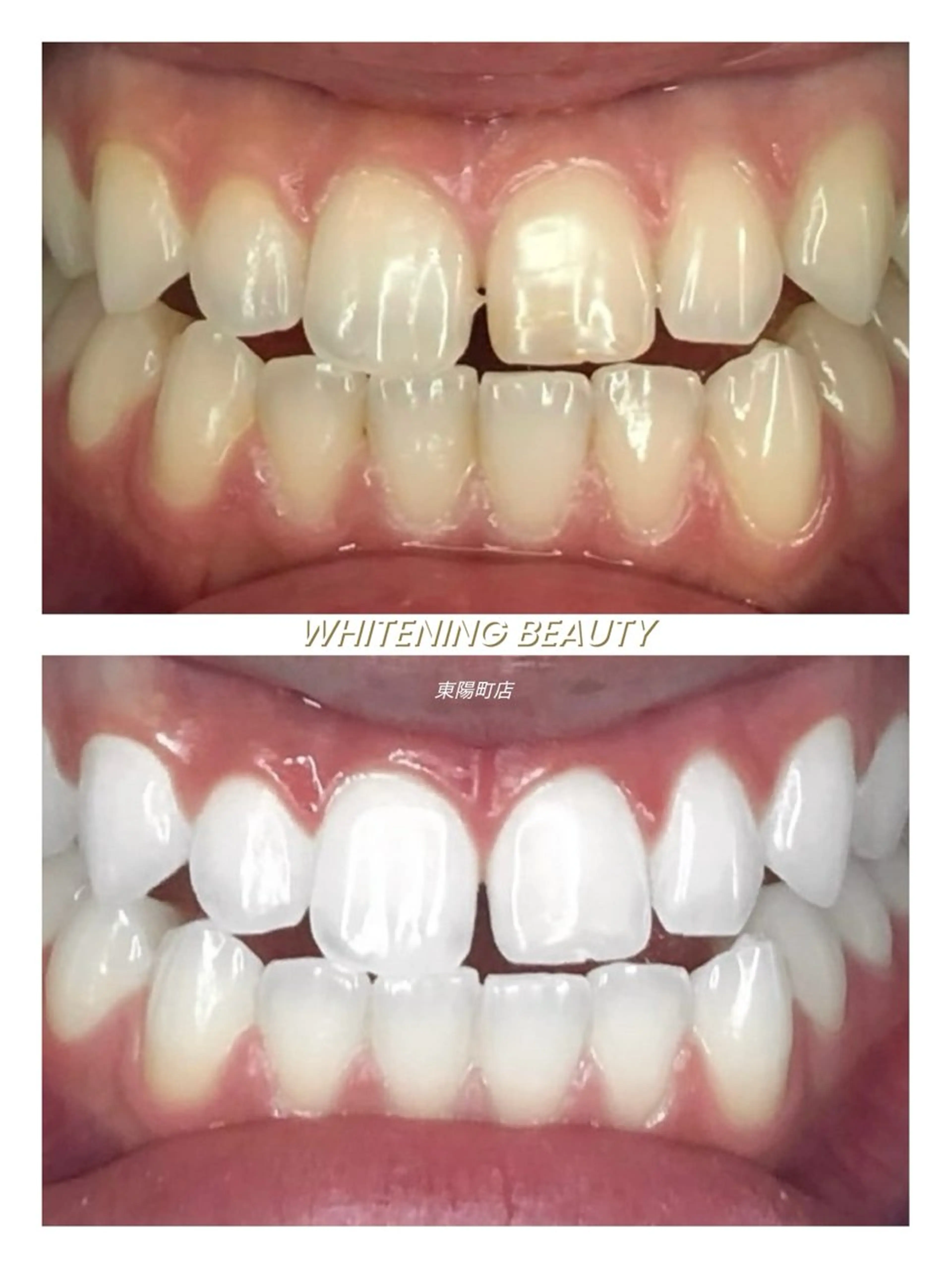 その他 ホワイトニング ビューティー東陽町店のその他イメージ