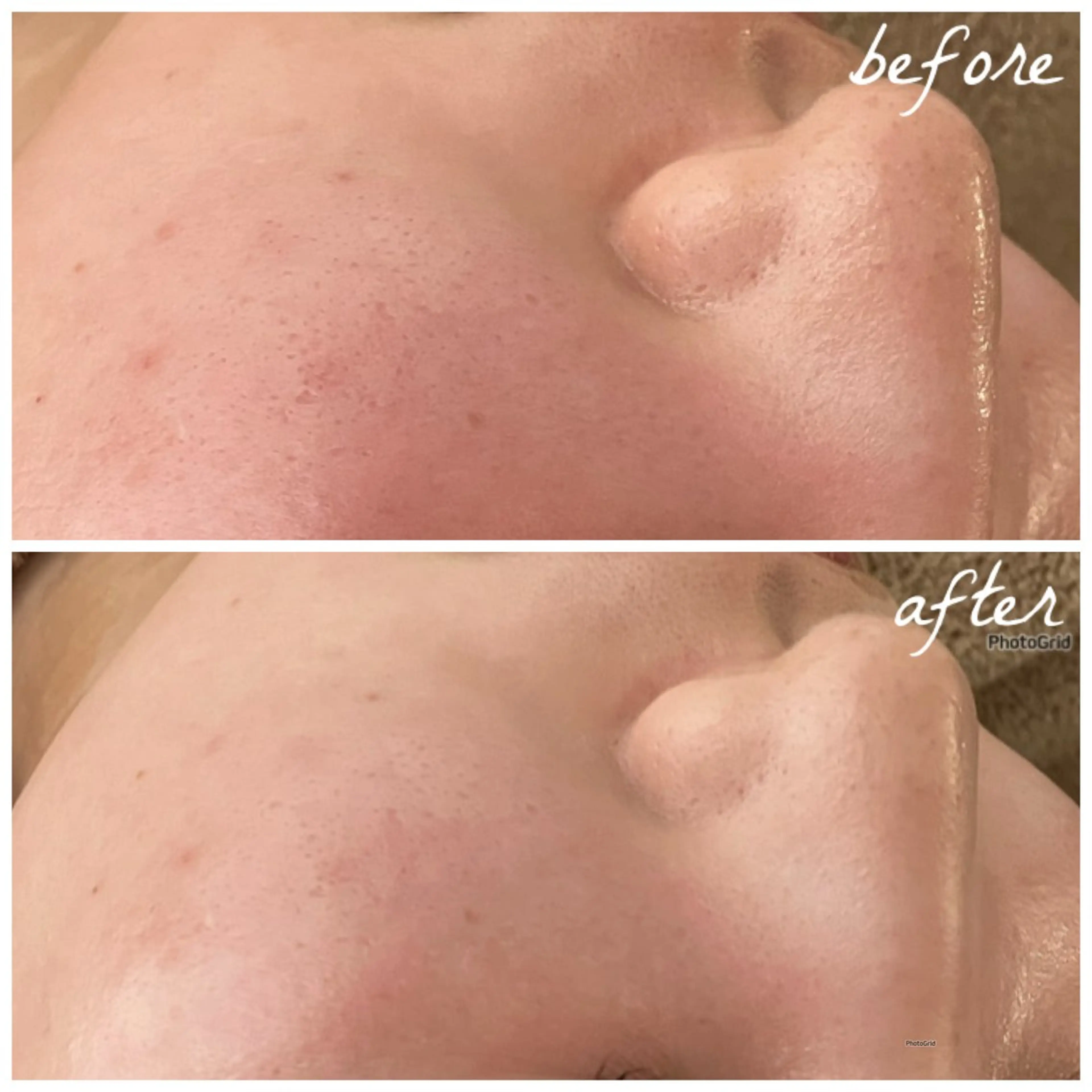 メンズ エステ メナード岐阜茜部 杉浦のエステ・リラクイメージ