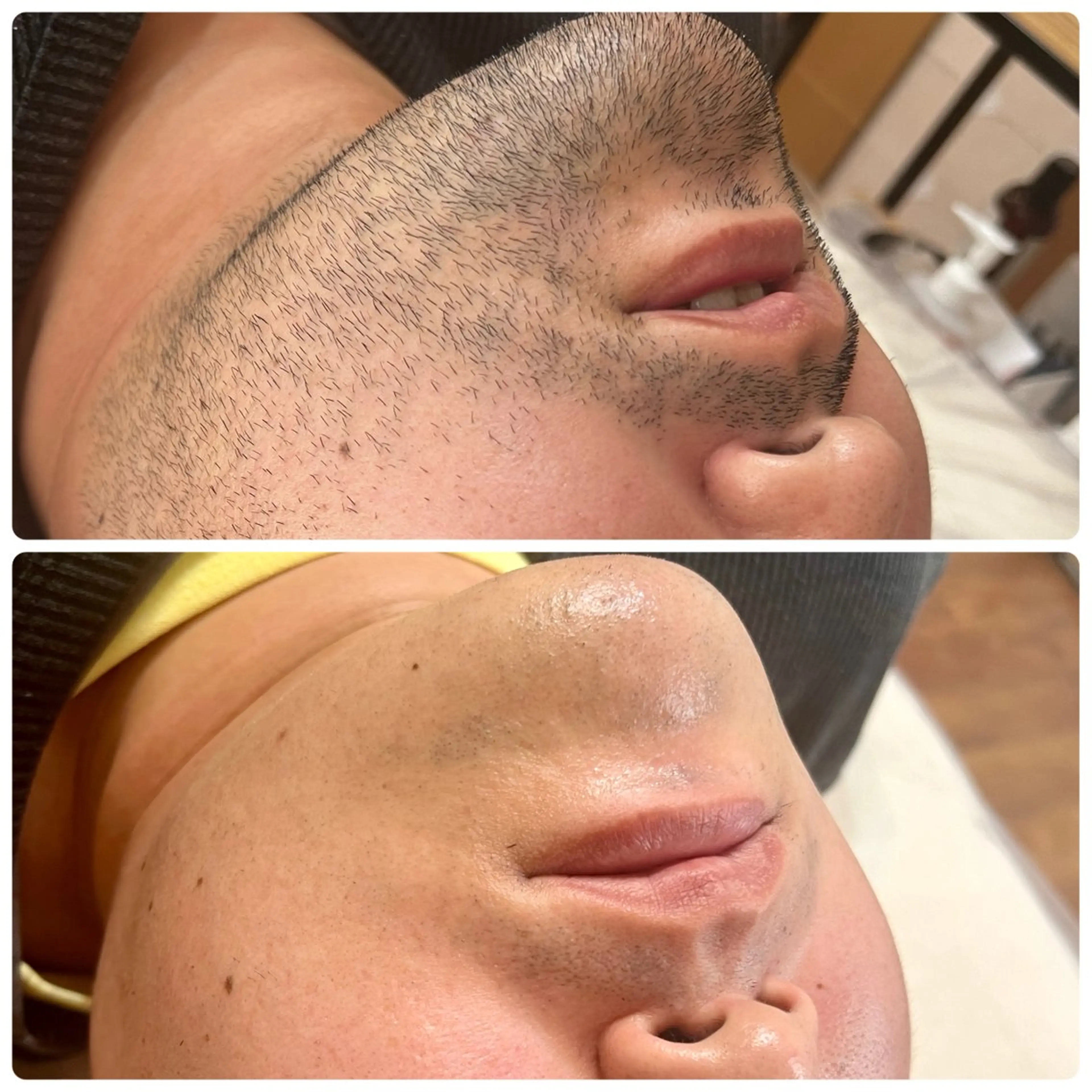 枚方市香里園脱毛 サロンCHICIELのエステ・リラクイメージ