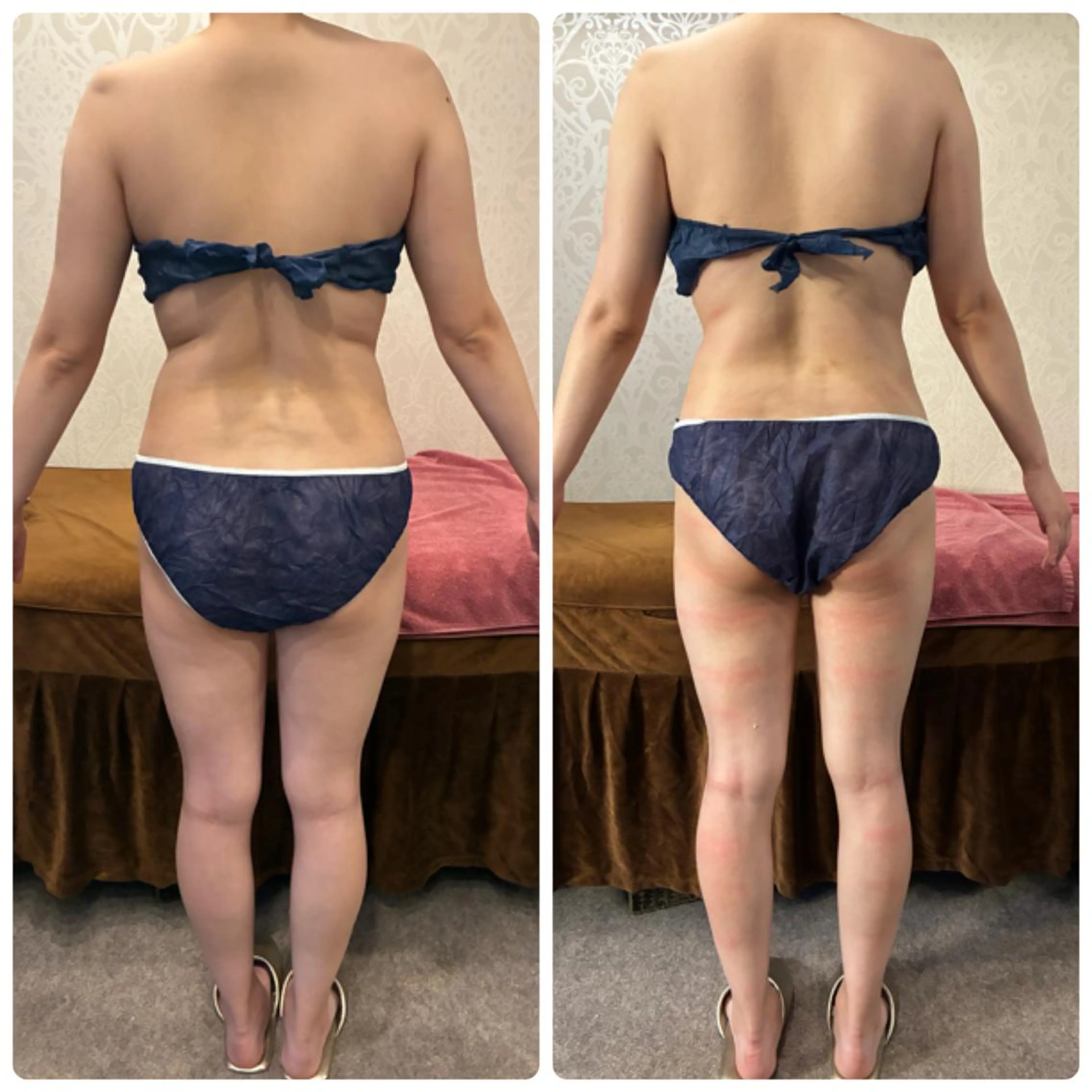 FLEUR 2号店のエステ・リラクイメージ