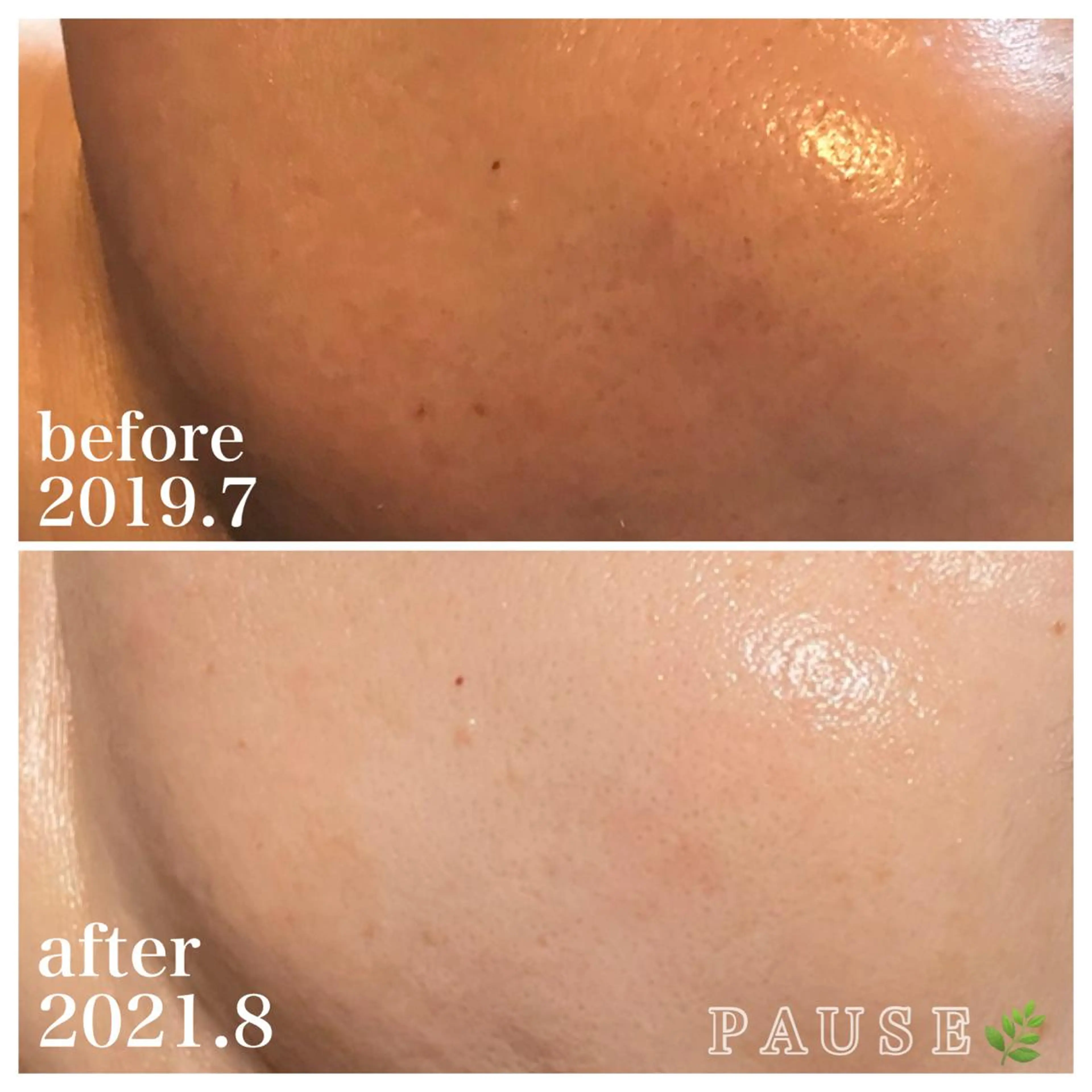 エステ リラク 浜野 恵美のエステ・リラクイメージ