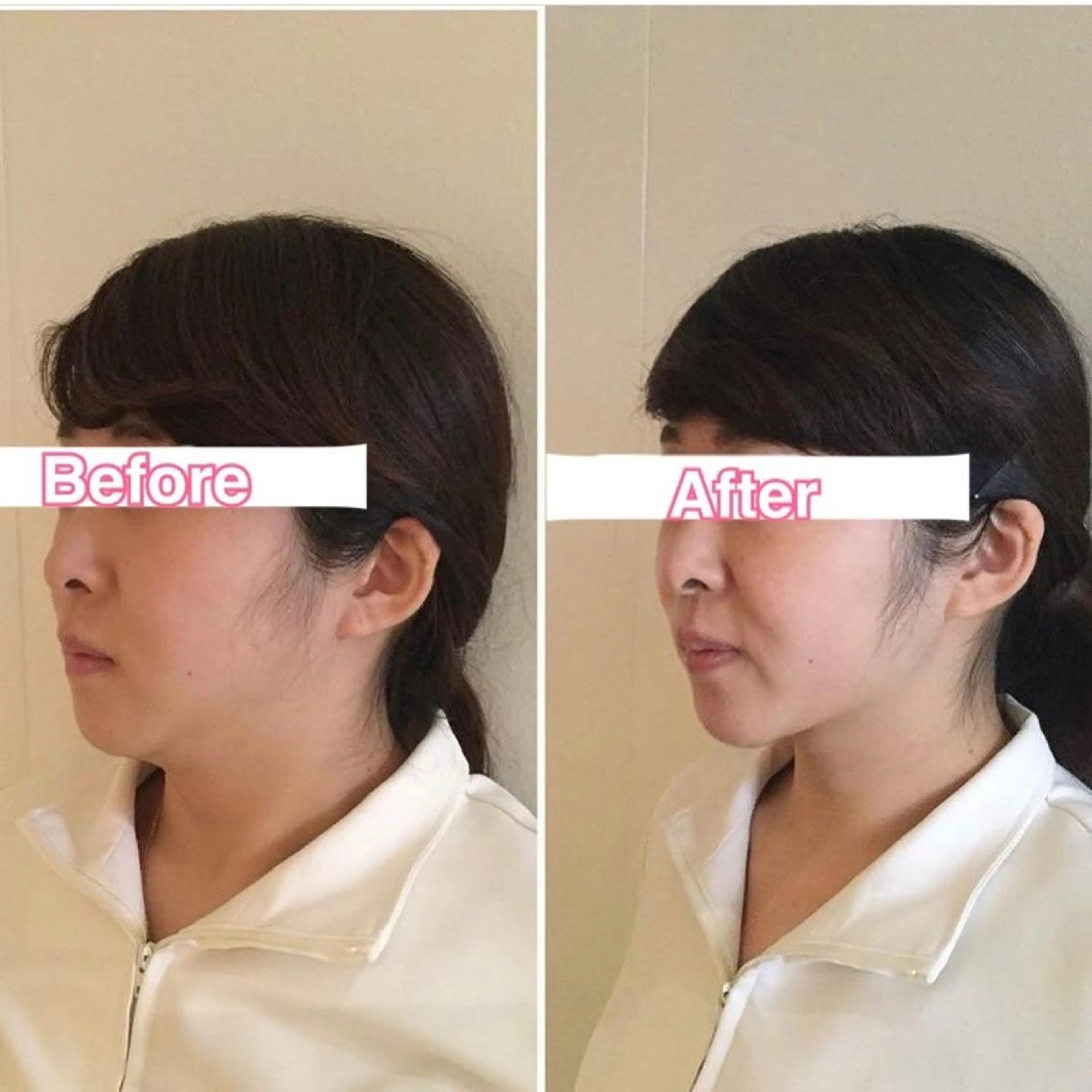 エステ リラク 美容鍼・整体サロン アネモネ🌸心斎橋のエステ・リラクイメージ