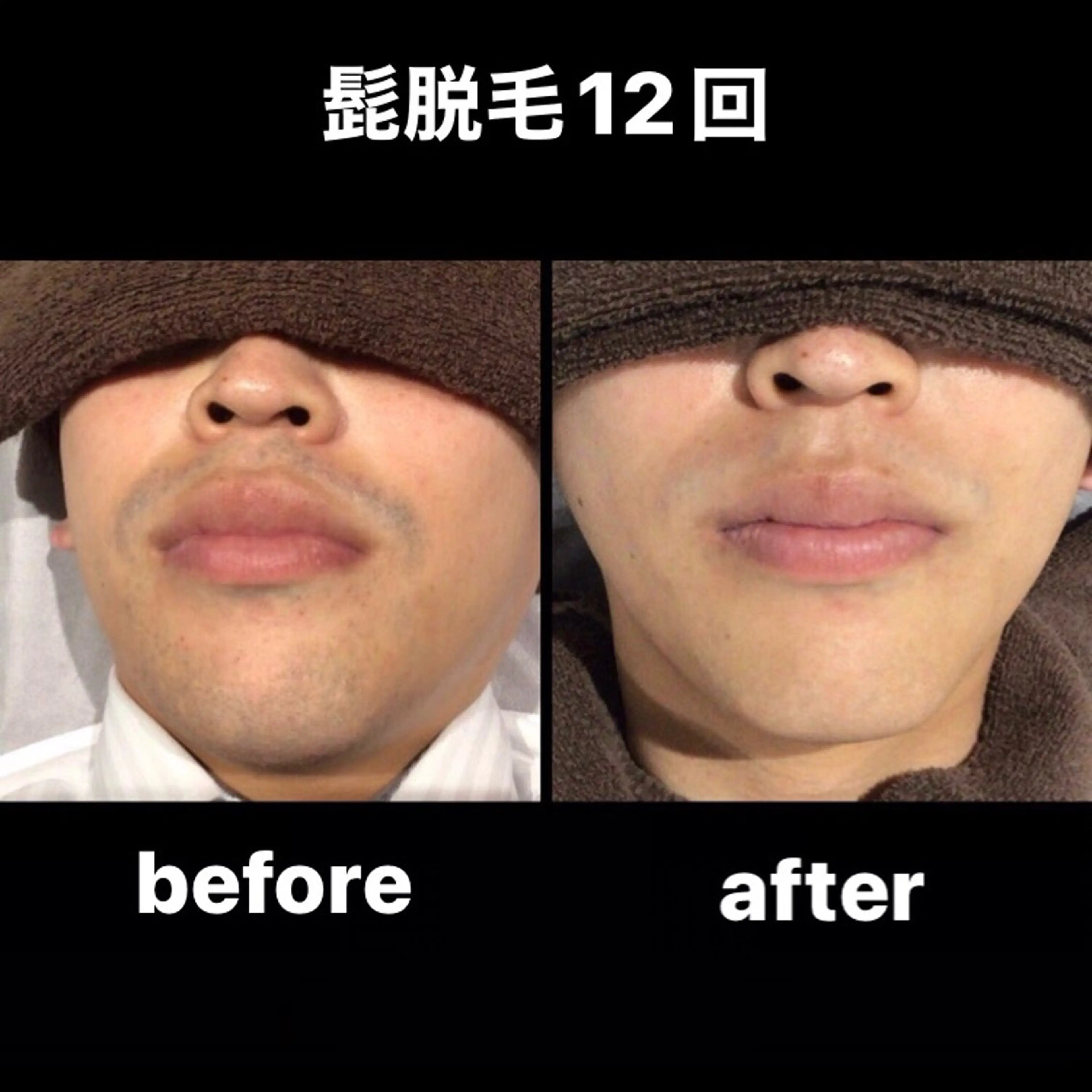 【都度払い制】　脱毛 ・エステ　Linoのエステ・リラクイメージ