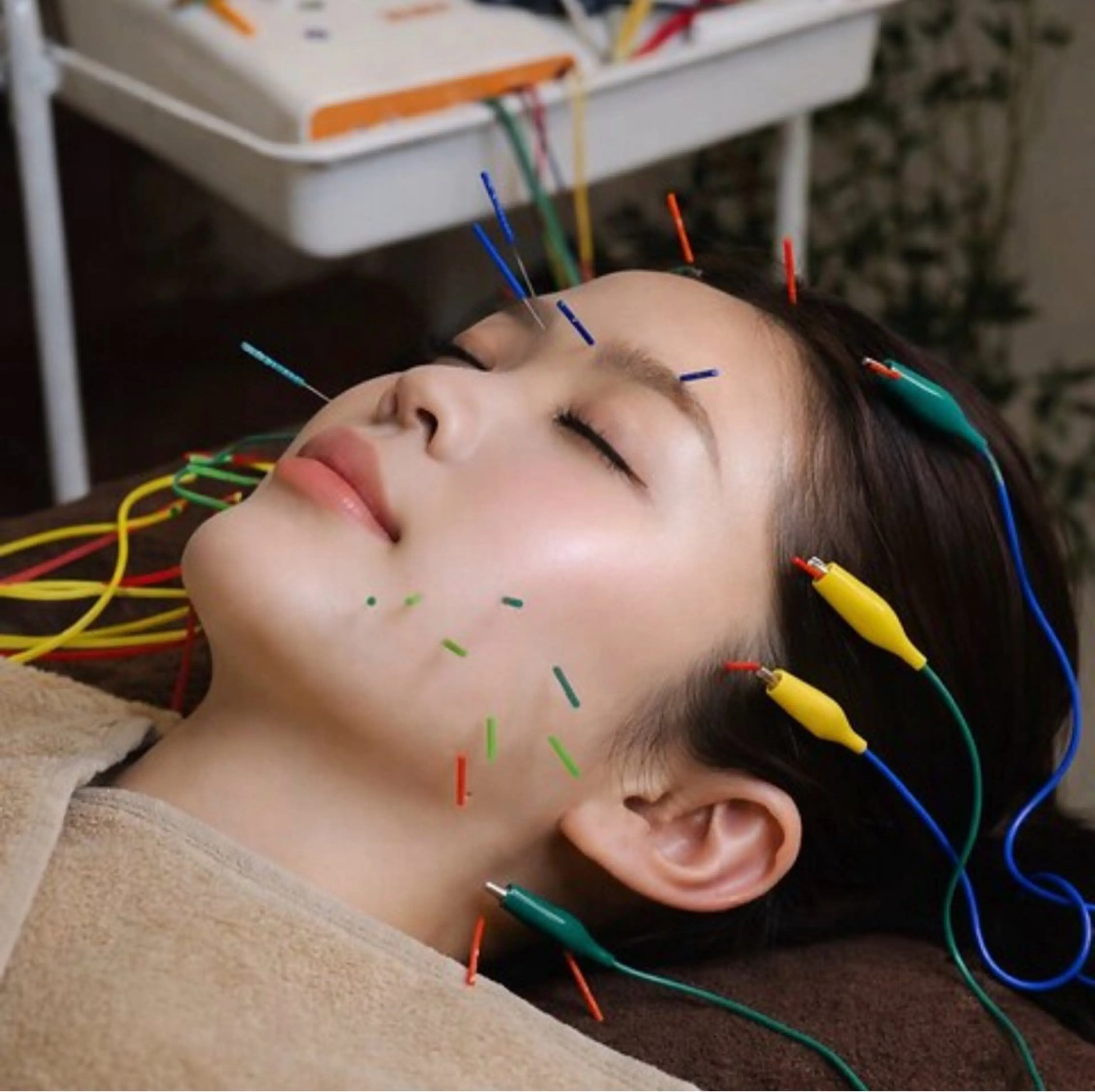 ≪リピーター様≫【美容鍼プレミアム】 90分¥15400🪡✨️ ‼️ご予約可能日は下記よりご確認下さい‼️の写真