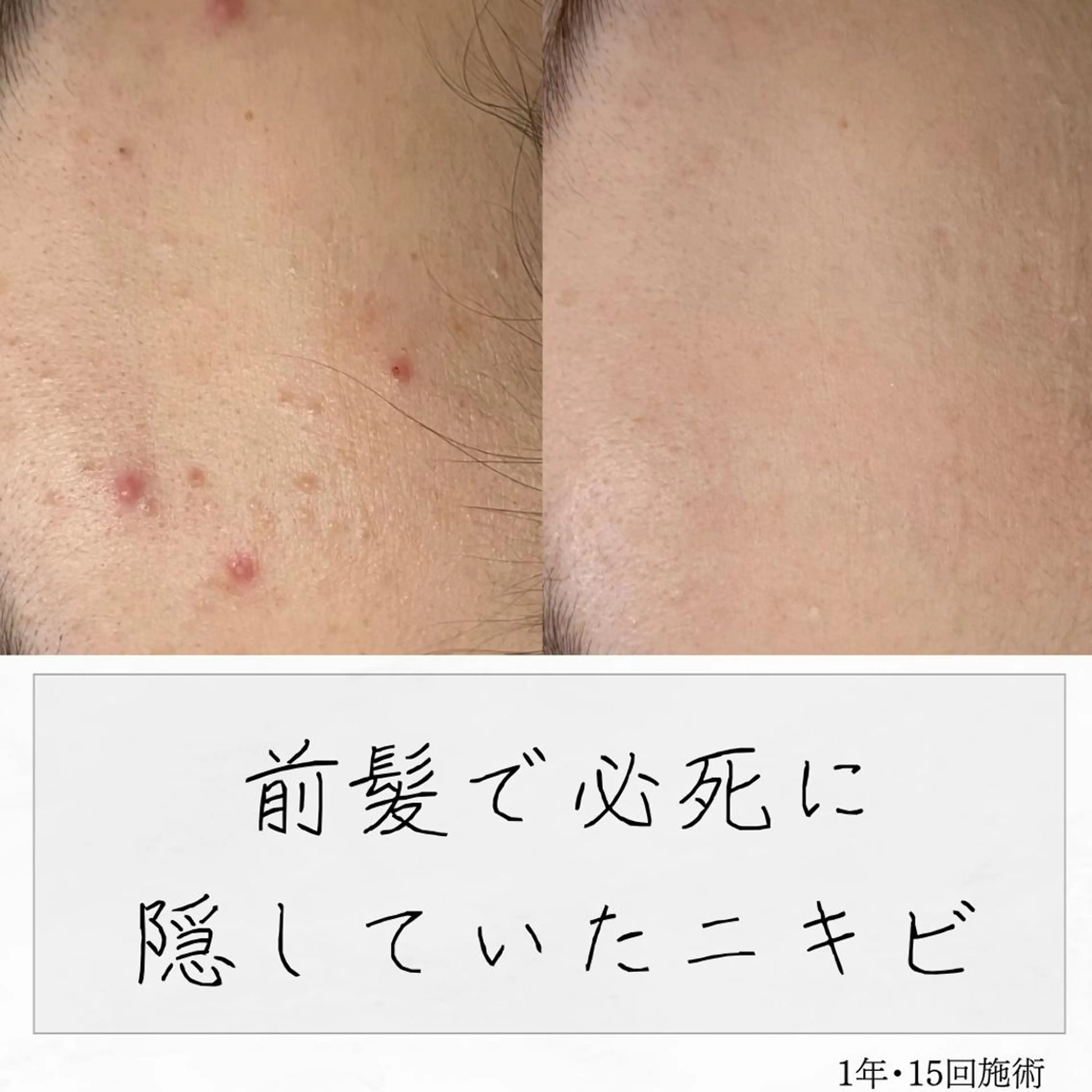 ニキビ経験者が施術 する専門サロン🌻のエステ・リラクイメージ