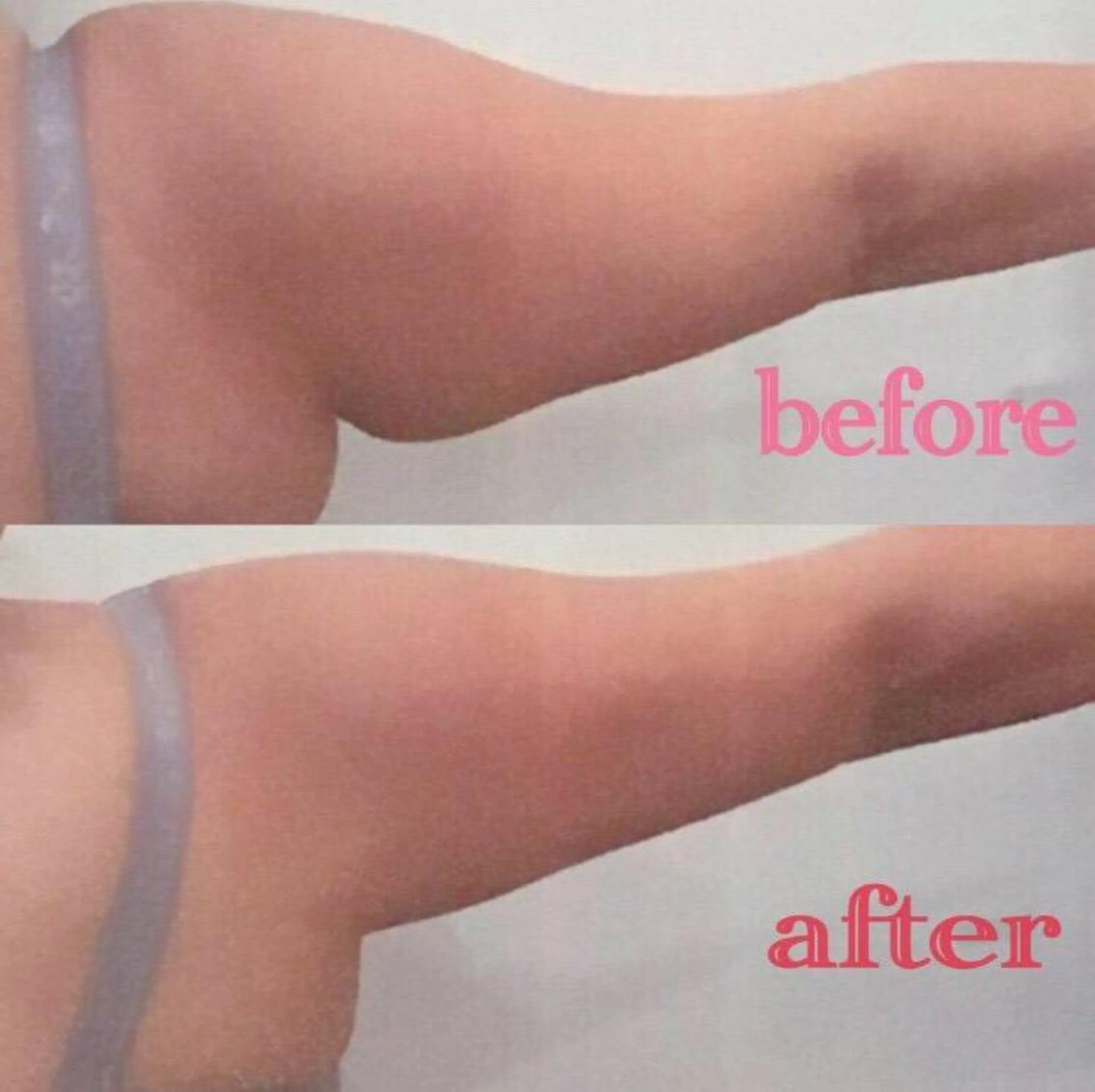 HappIness 遠赤外線ドームのエステ・リラクイメージ