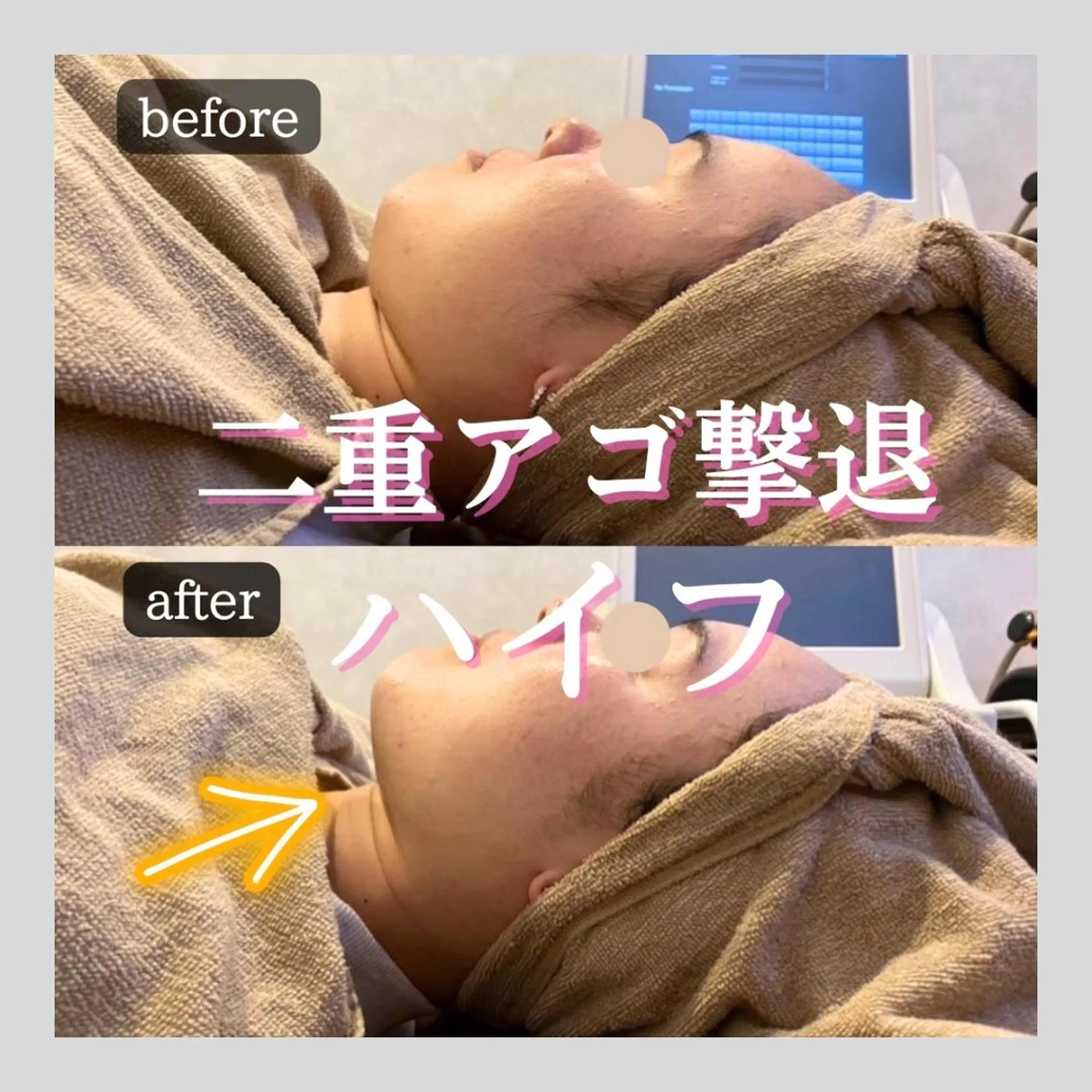 第一印象専門サロン ADISEのエステ・リラクイメージ