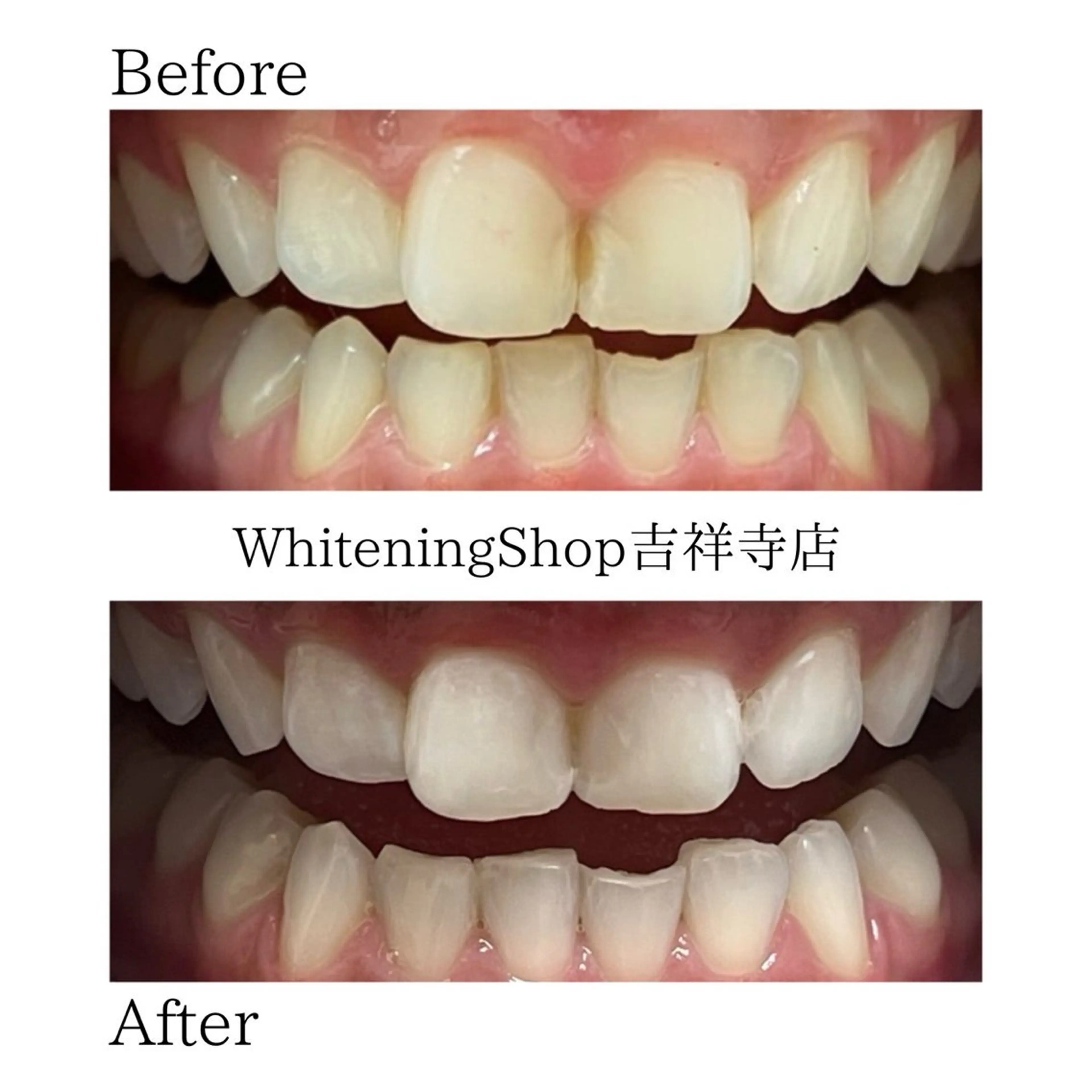 エステ リラク ホワイトニング ショップ吉祥寺店のエステ・リラクイメージ