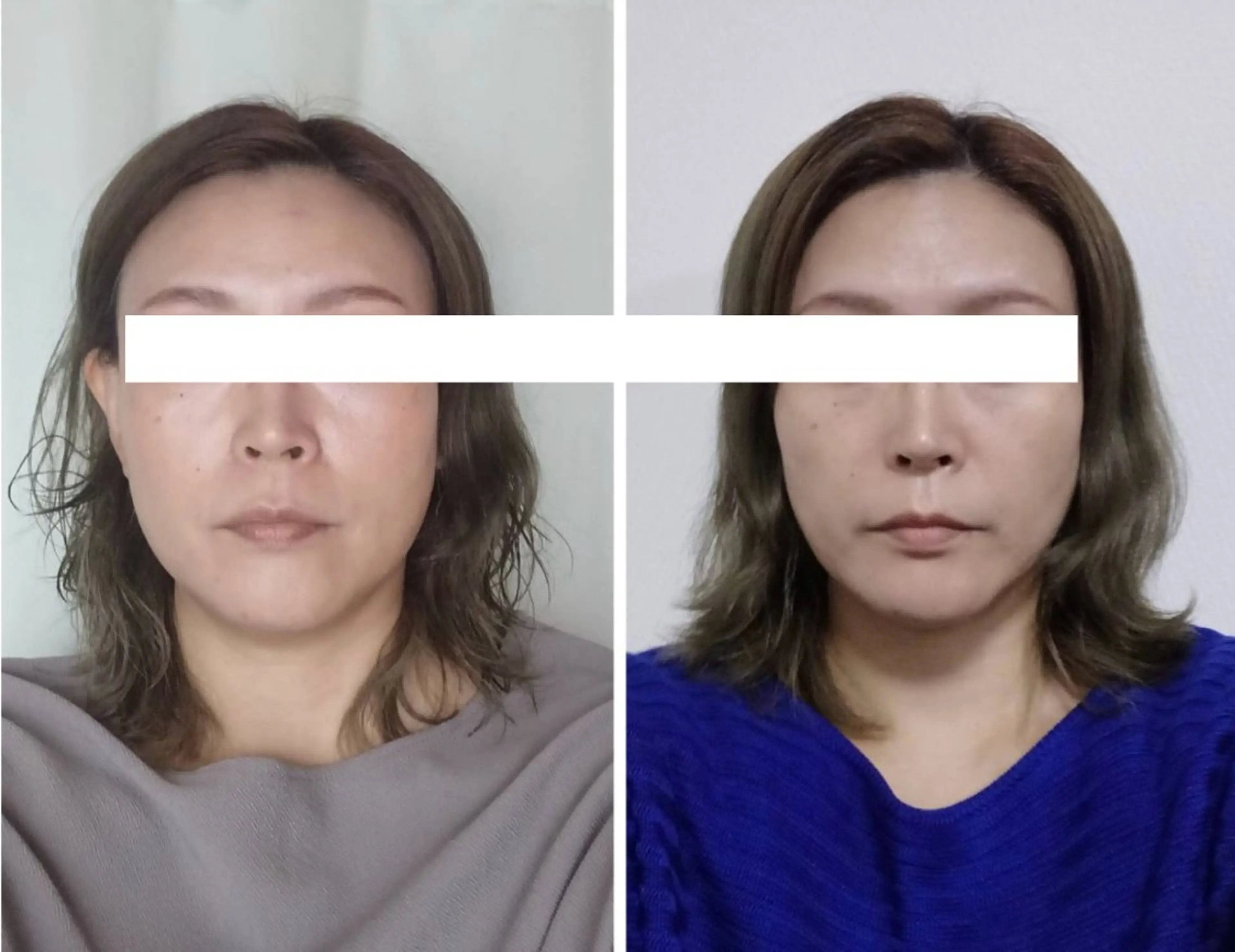 丸顔さんの救世主 高田 くみのエステ・リラクイメージ