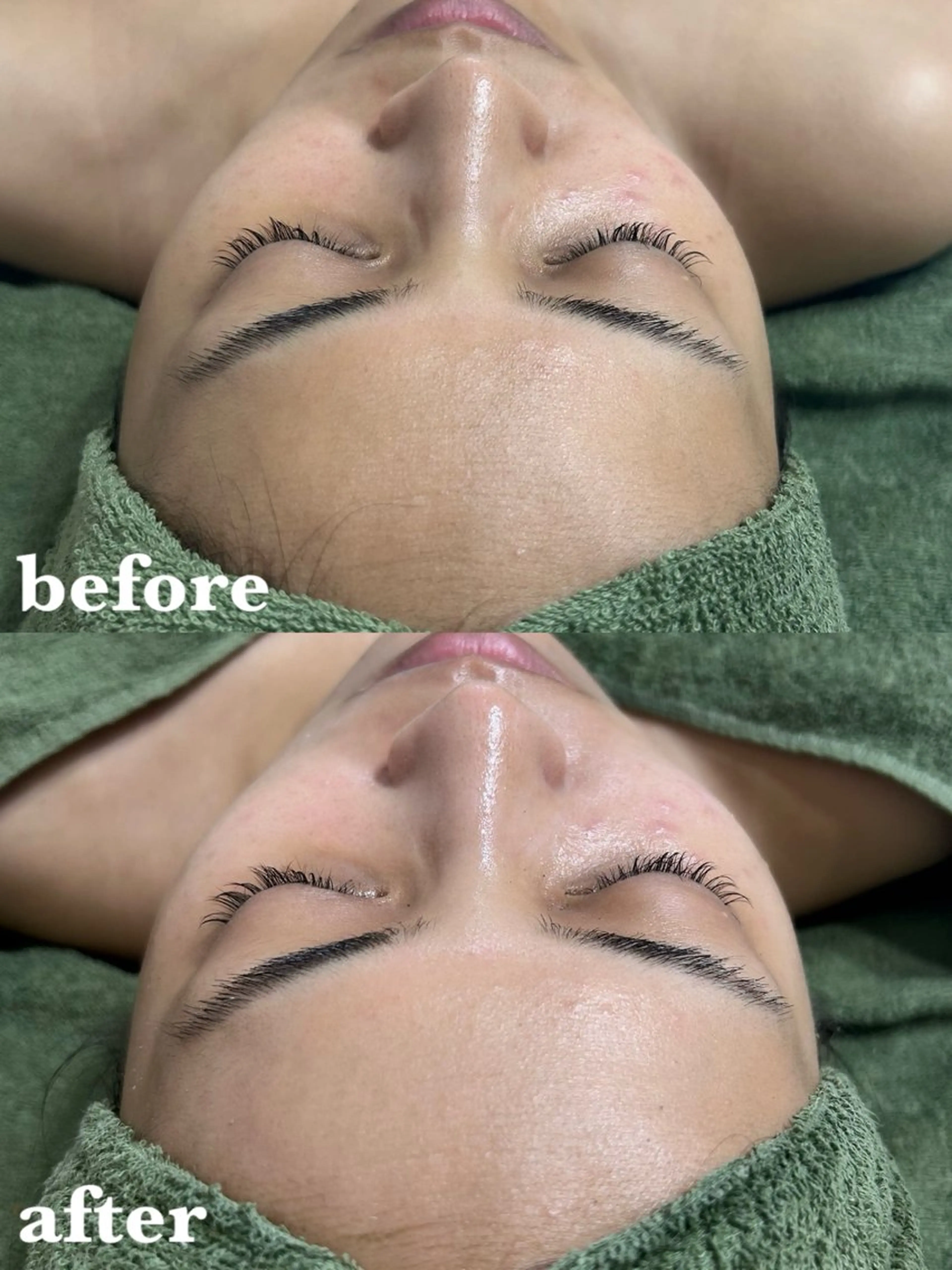 肌質改善＆脱毛 【M Mondo】のエステ・リラクイメージ