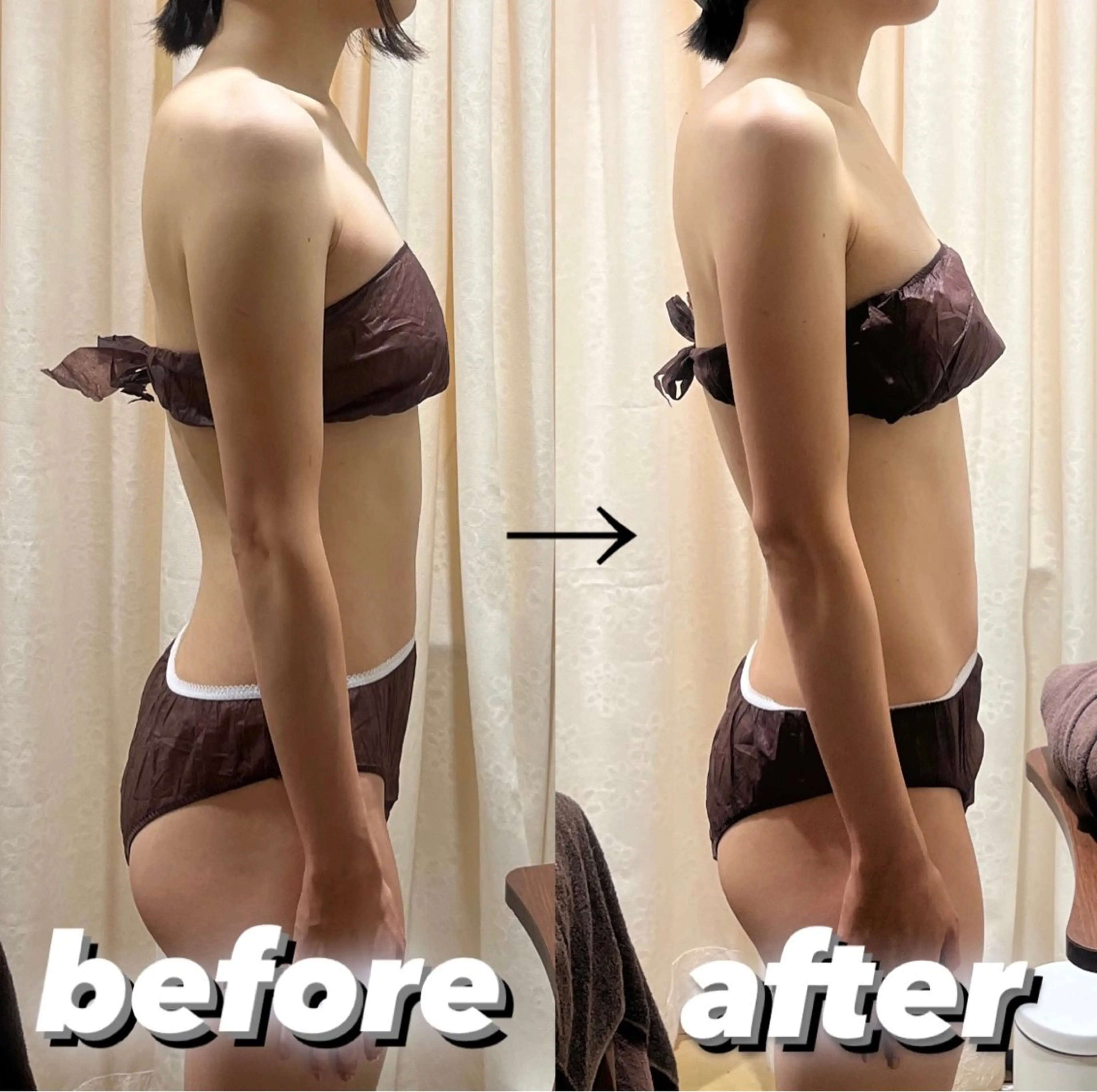 【ブライダル限定💐】ドレスから見える部分集中✨60分×3回オーダーメイドコース！の写真