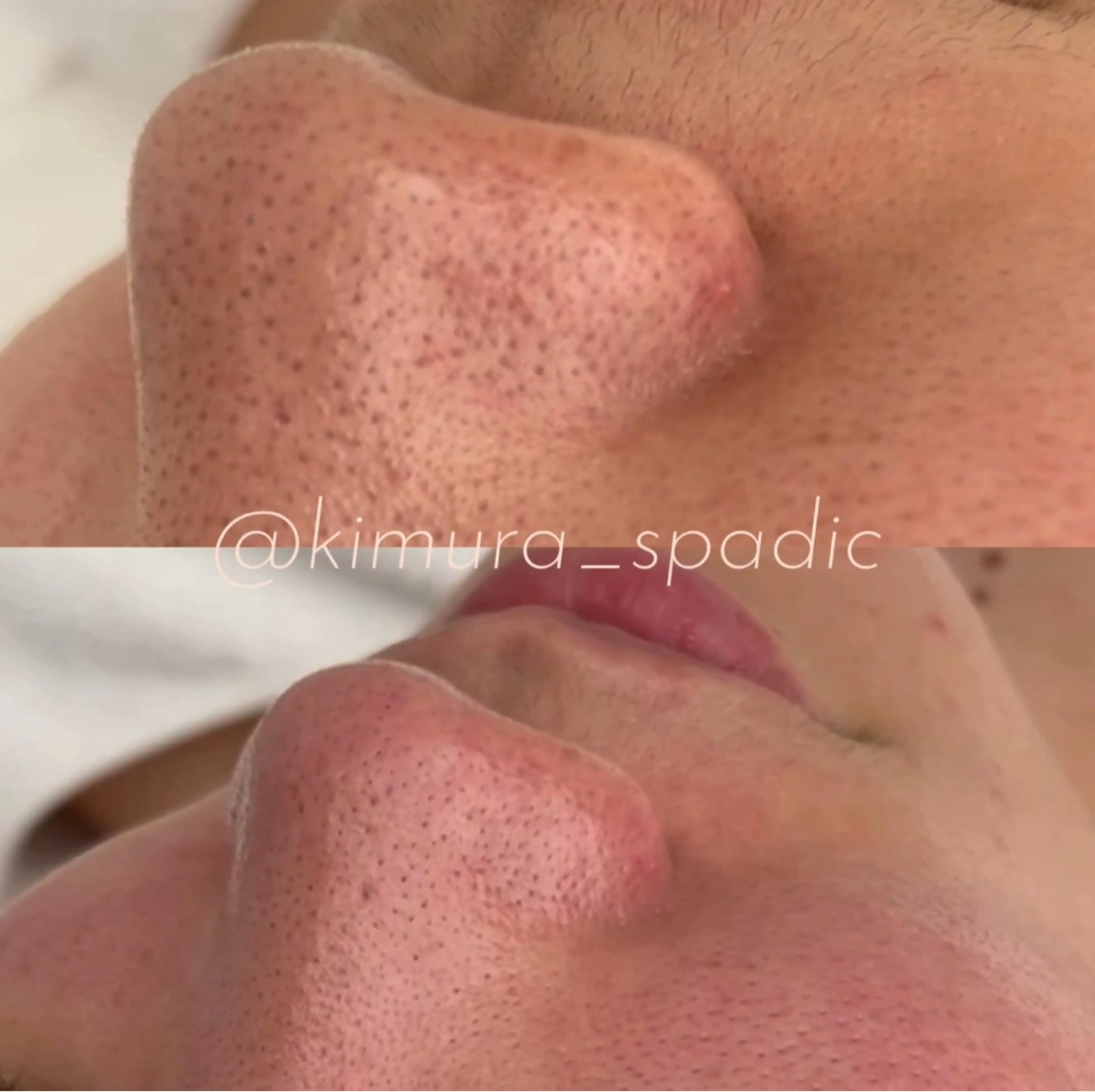 エステ 木村 ゆきのエステ・リラクイメージ