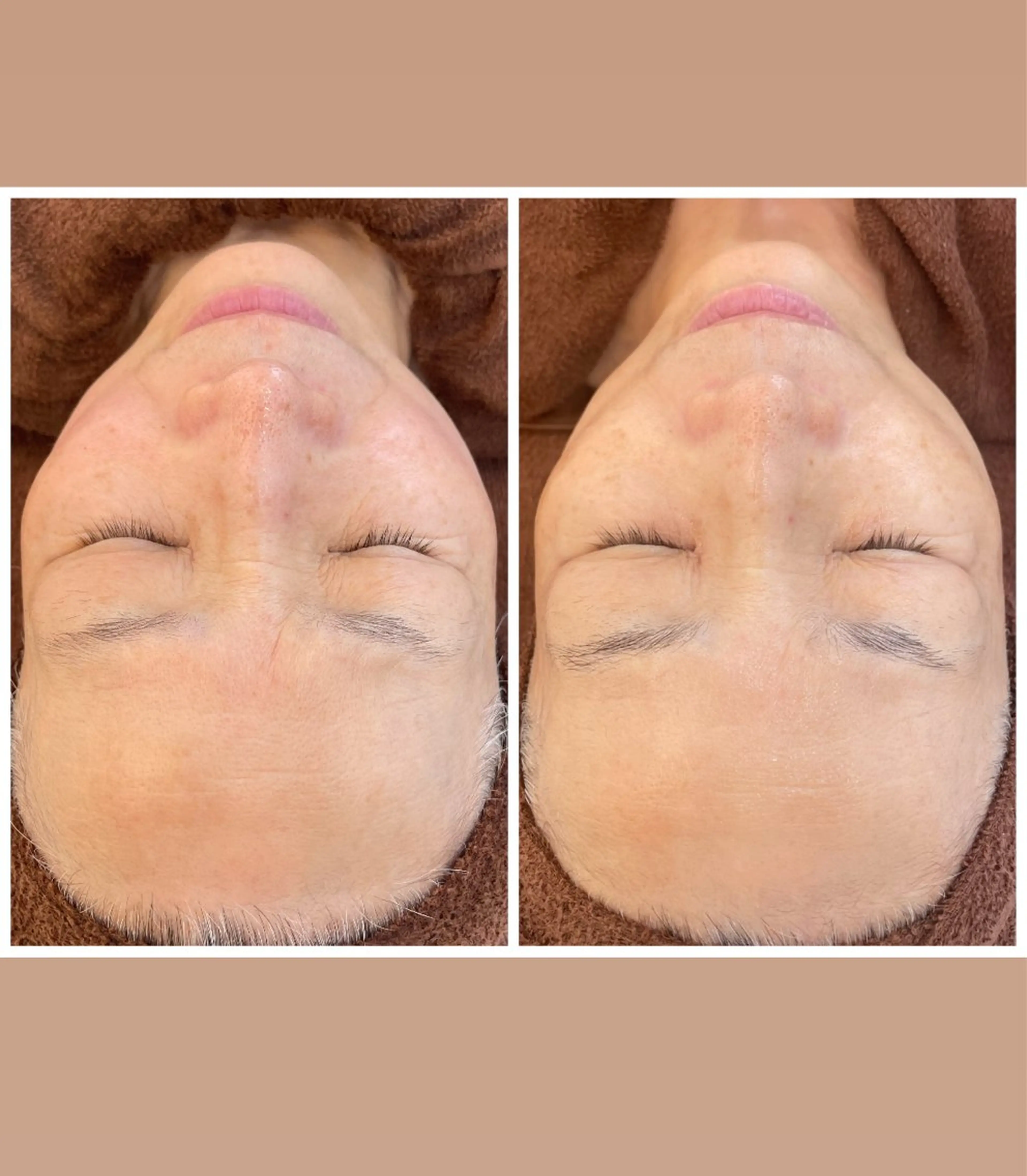 パーソナルスキンケア 🦋APRI🅿️有のエステ・リラクイメージ