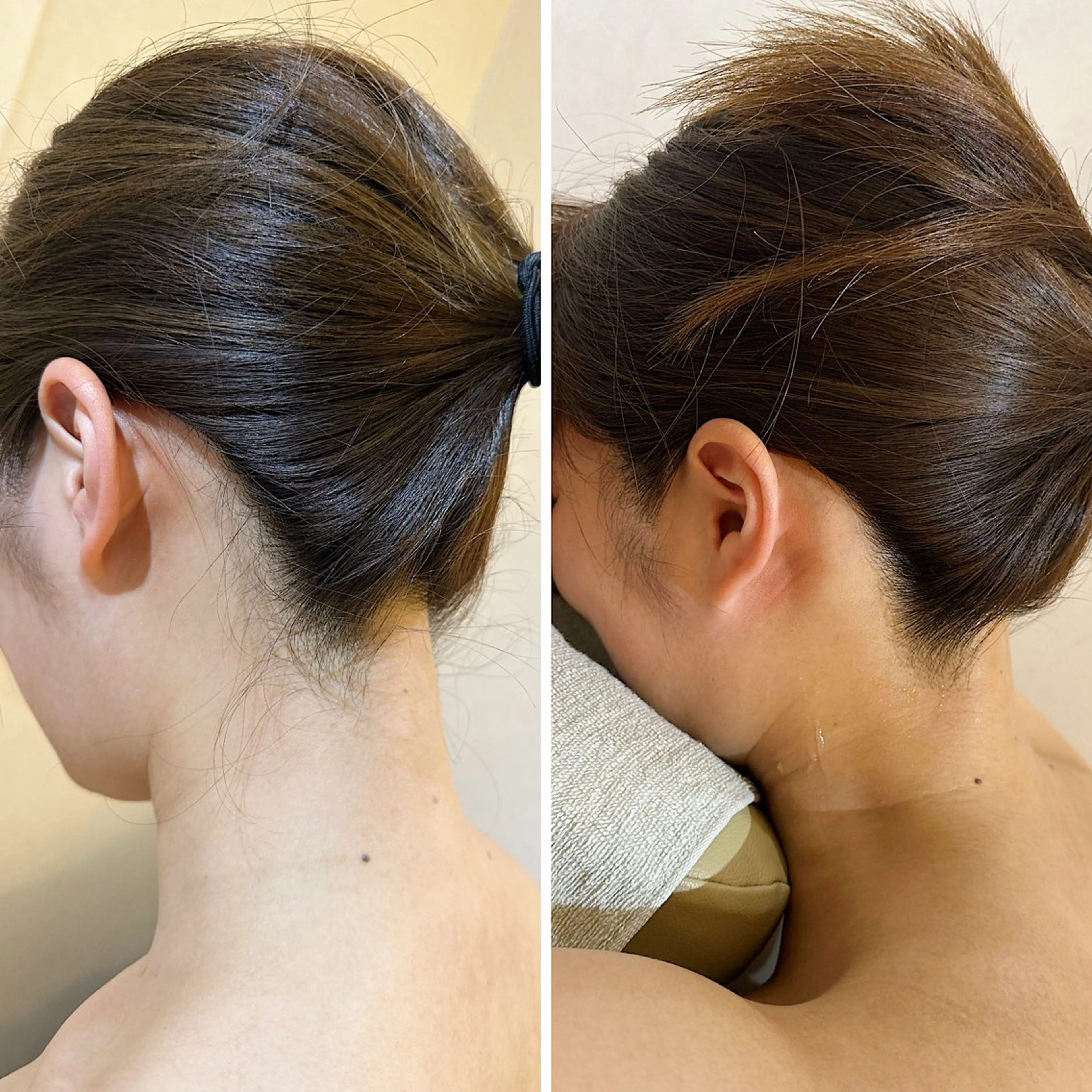 脱毛 うなじ脱毛/美肌脱毛 LABELのエステ・リラクイメージ