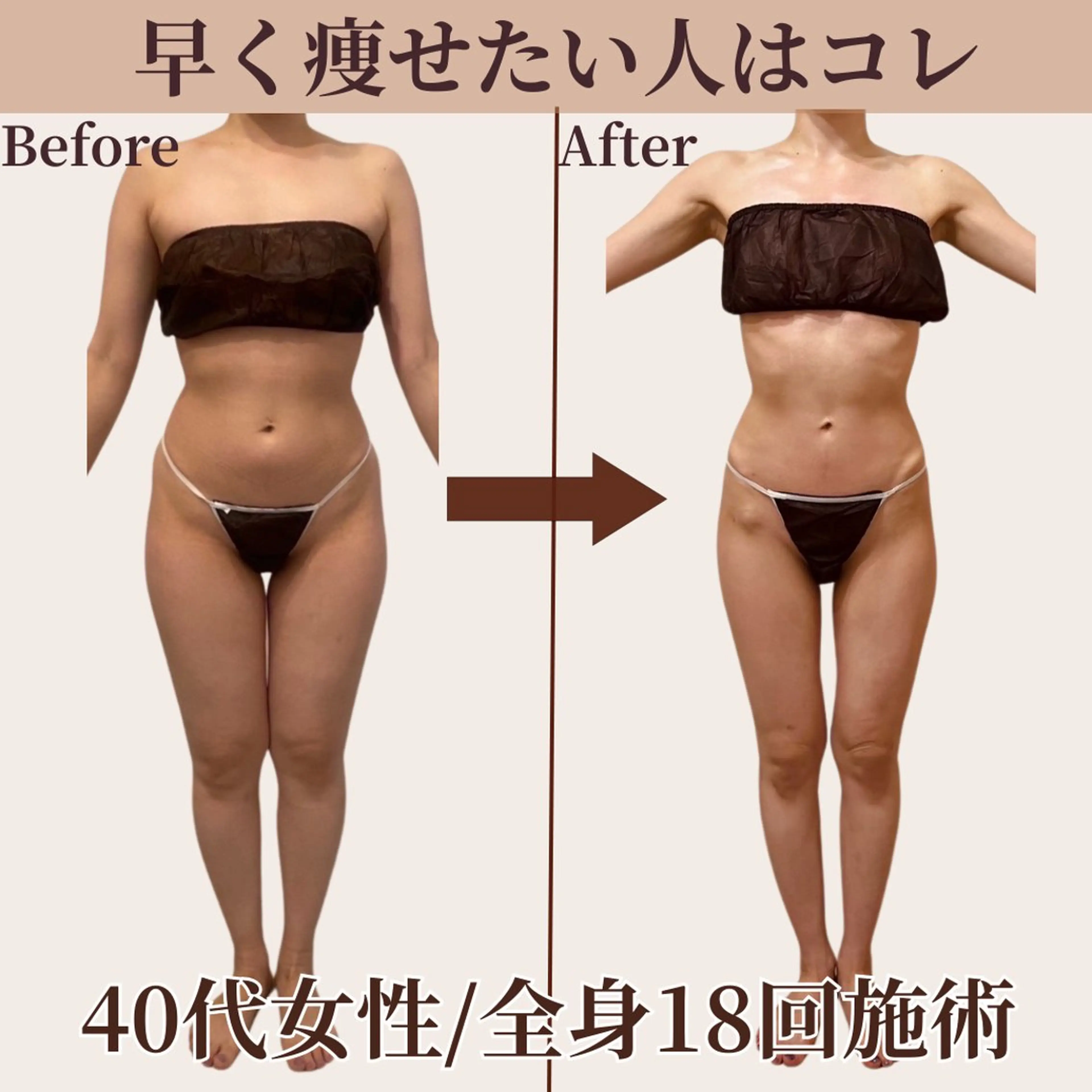 【全身☆痩身】360°大変身！早く痩せたいならこちら♪憧れのLL→Mにサイズダウン★《初回限定💫特別価格》の写真