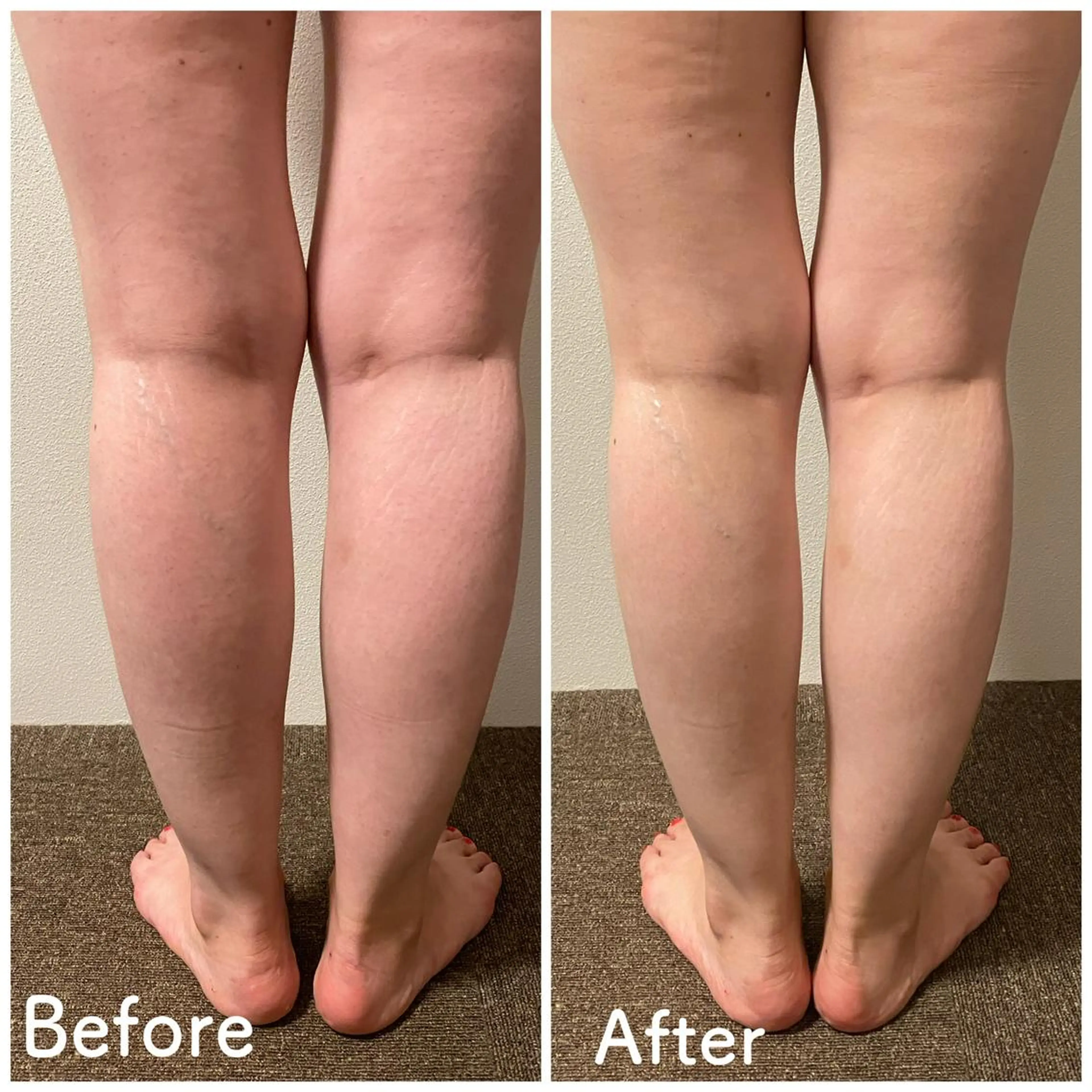 エステ リラク 小顔毛穴✨✨ POLA弥富駅前店のエステ・リラクイメージ