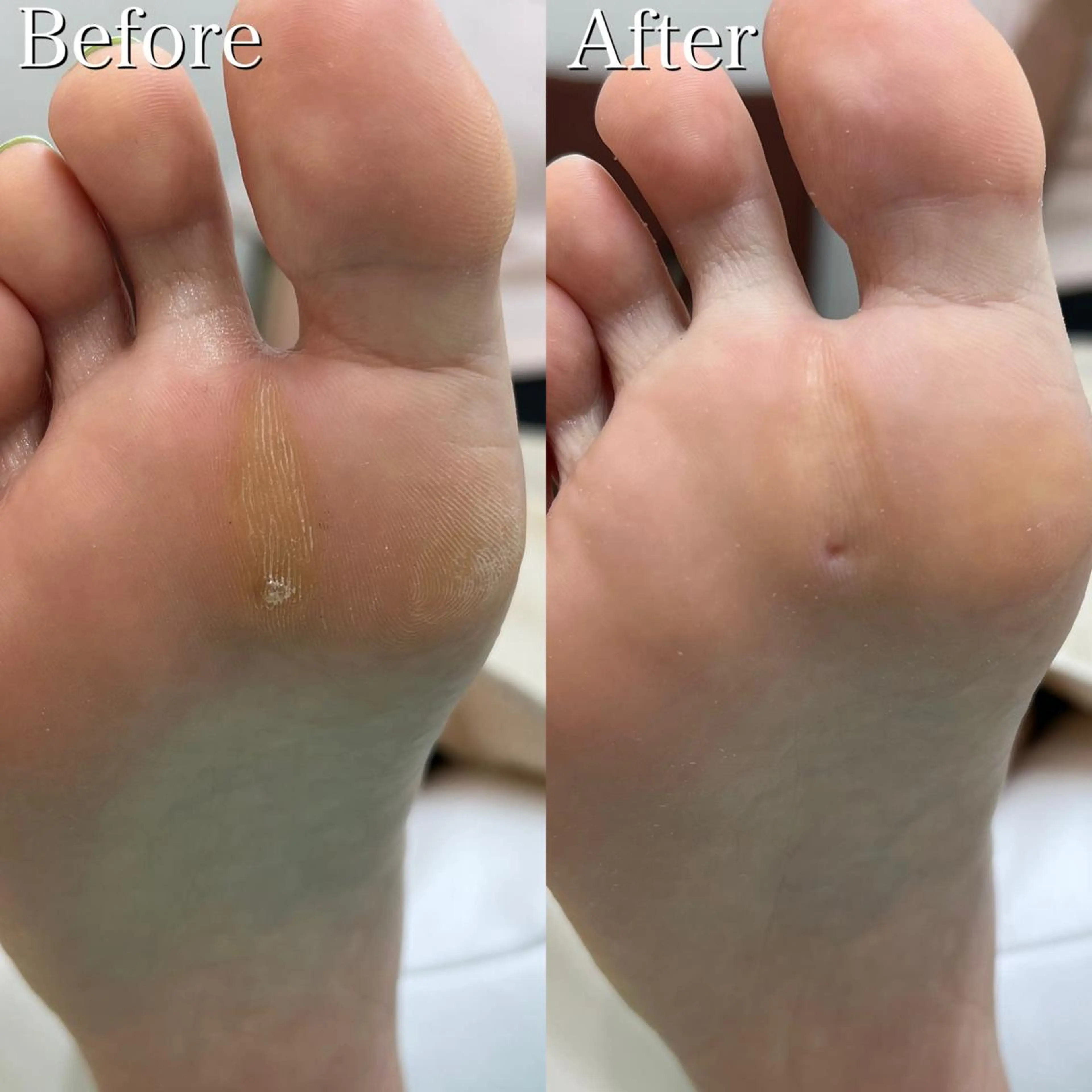 ネイル 東京巻き爪 アカデミーのエステ・リラクイメージ