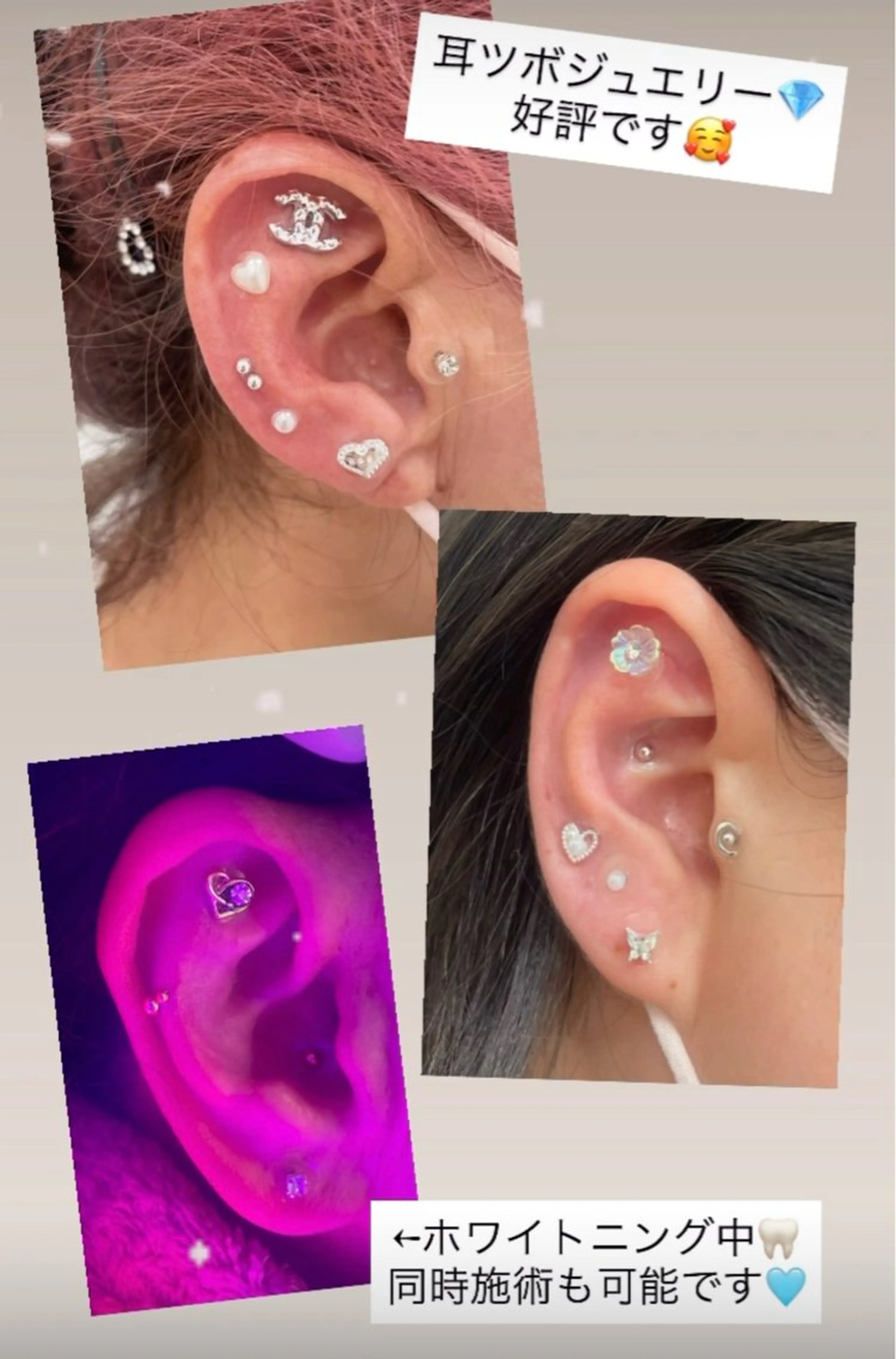 Kaula ホワイトニング🦷✨のエステ・リラクイメージ