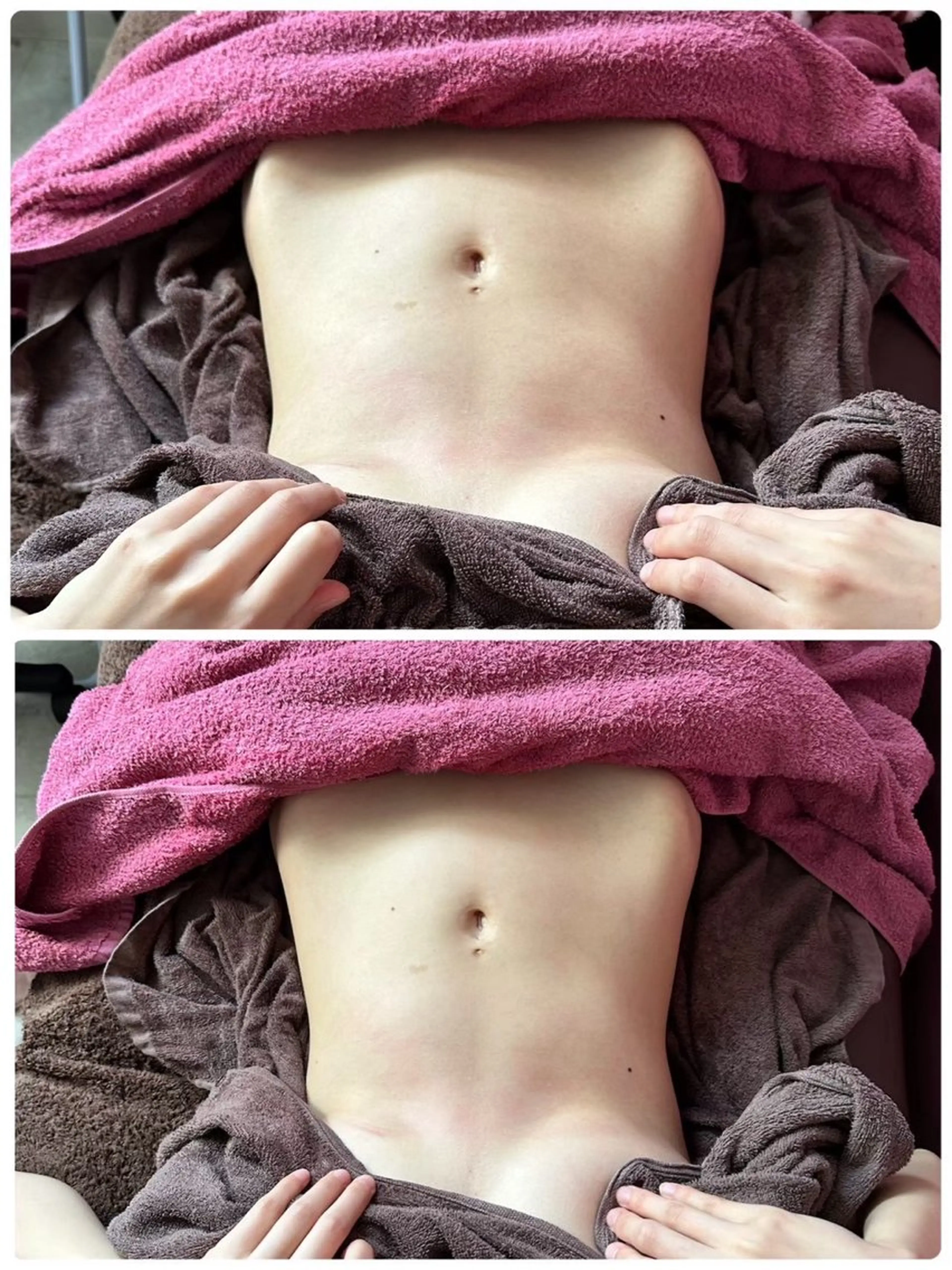 痩身エステ(上半身or下半身)の写真