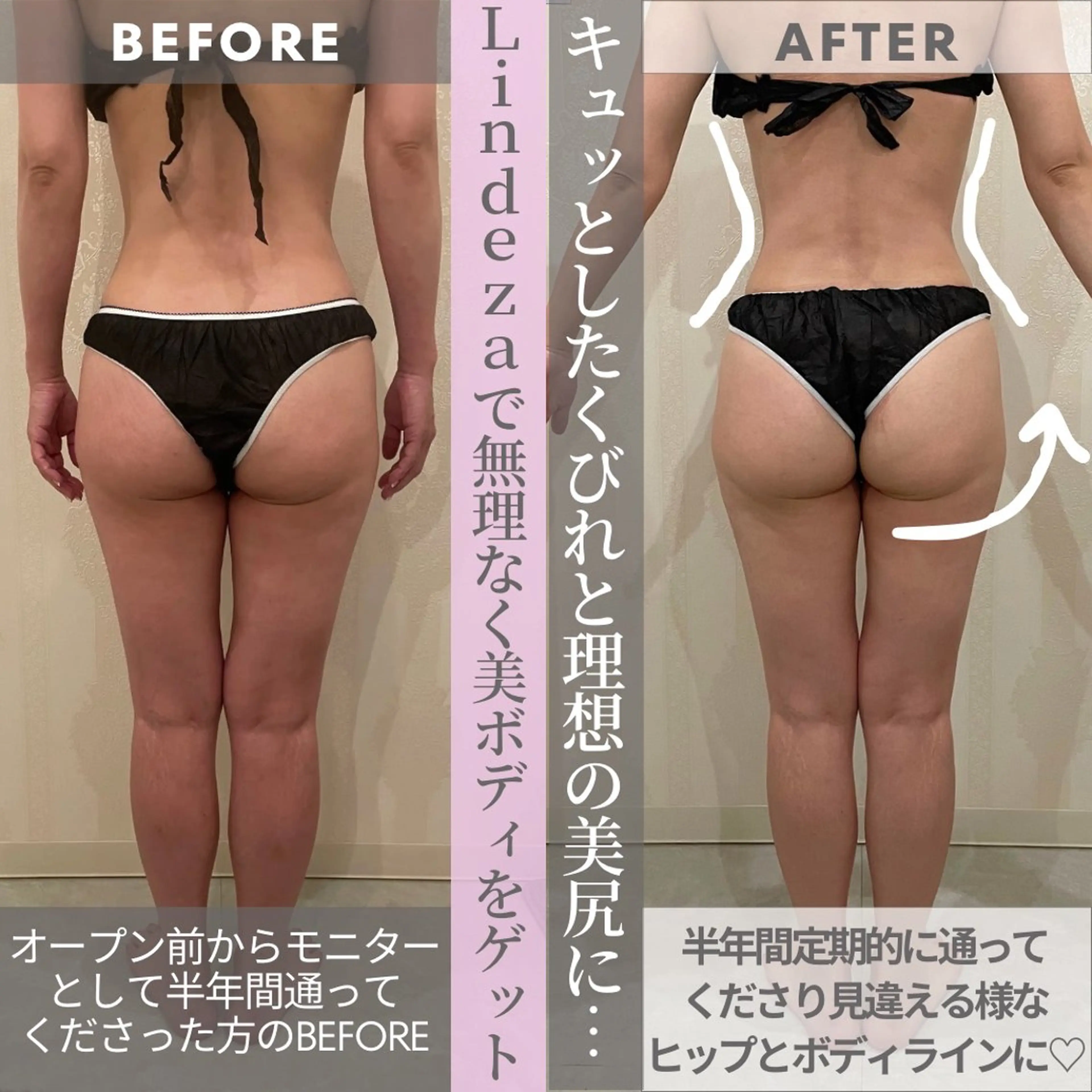 リンデザ 山口のエステ・リラクイメージ