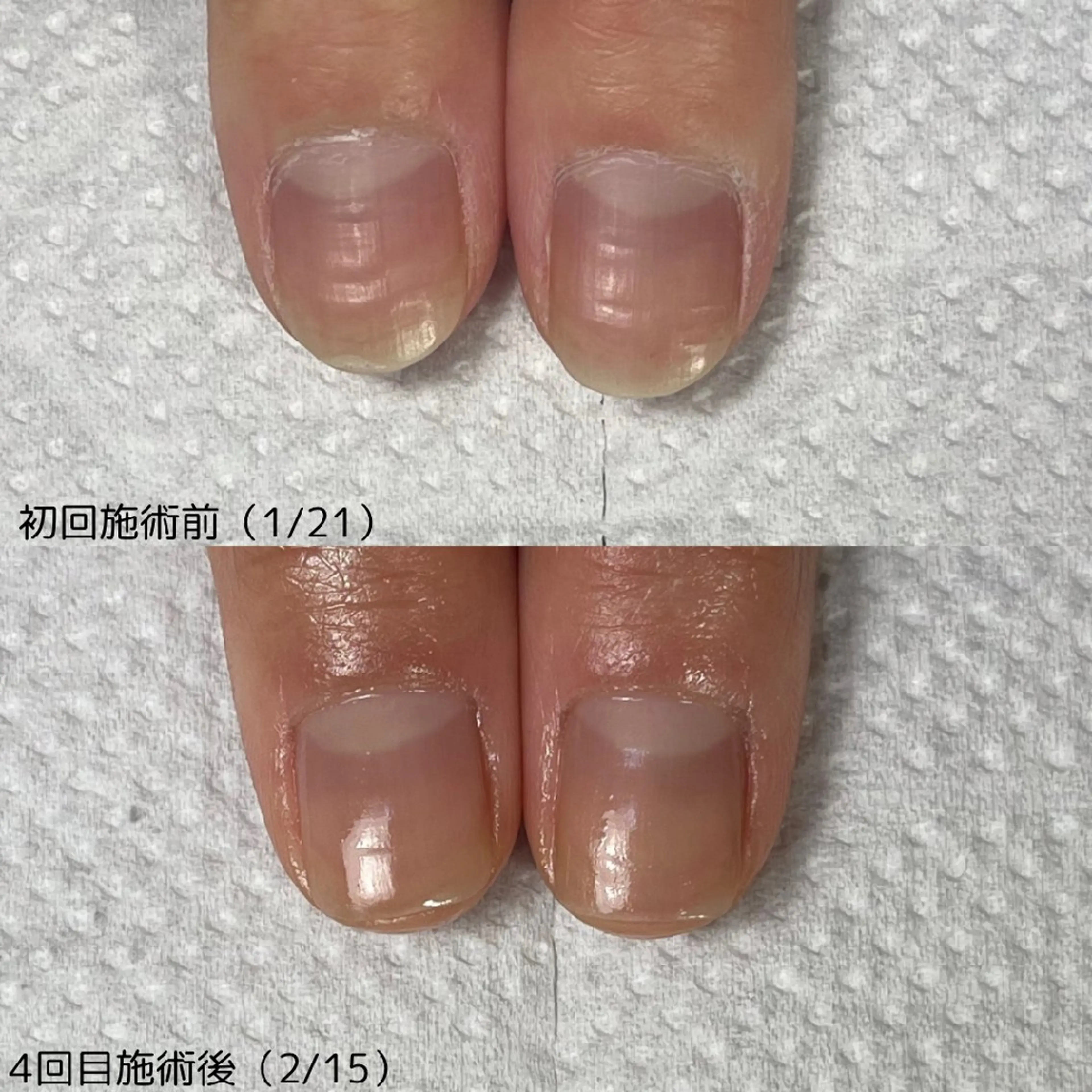ネイル nail 1623のネイルデザイン