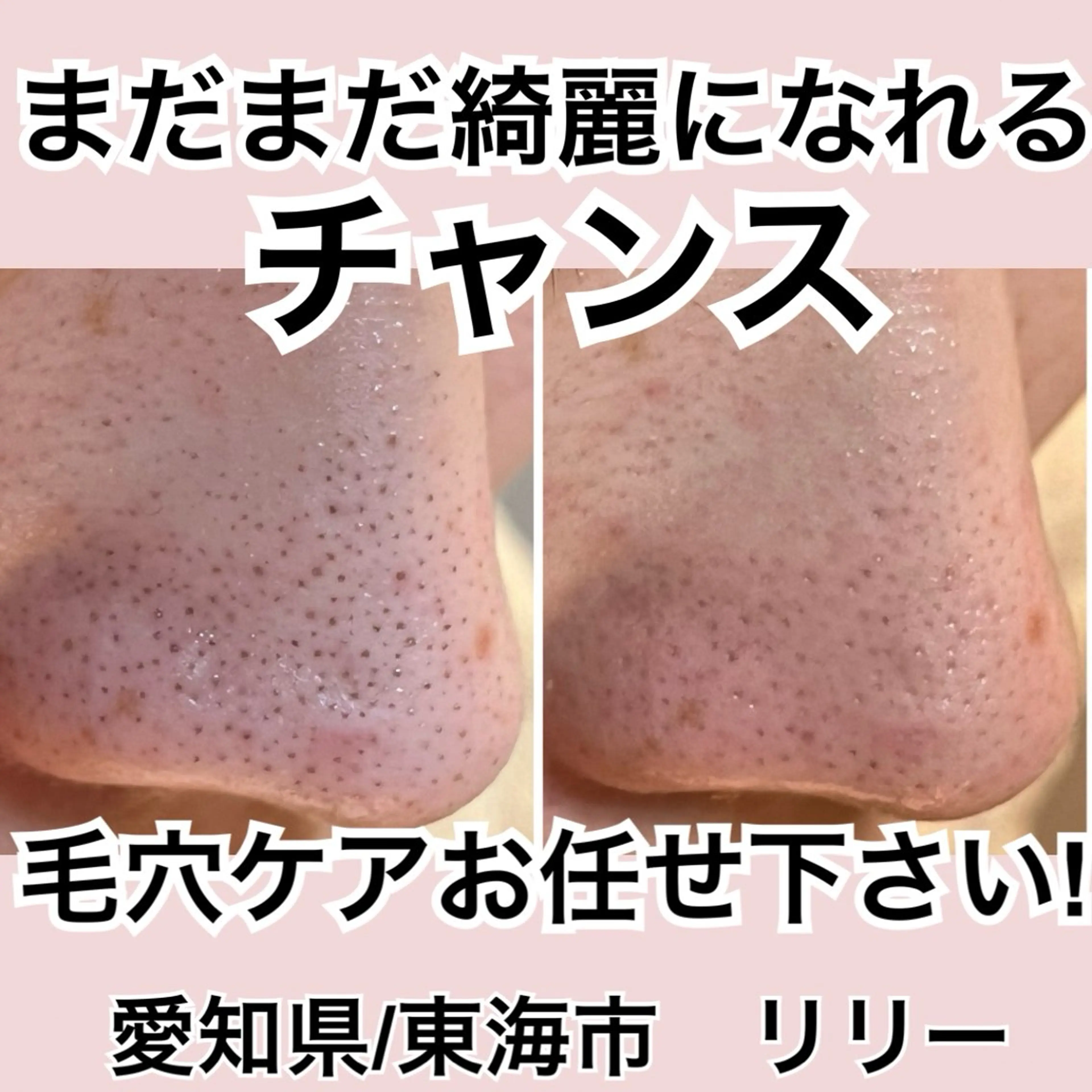 トータルビューティー サロンLilyのエステ・リラクイメージ