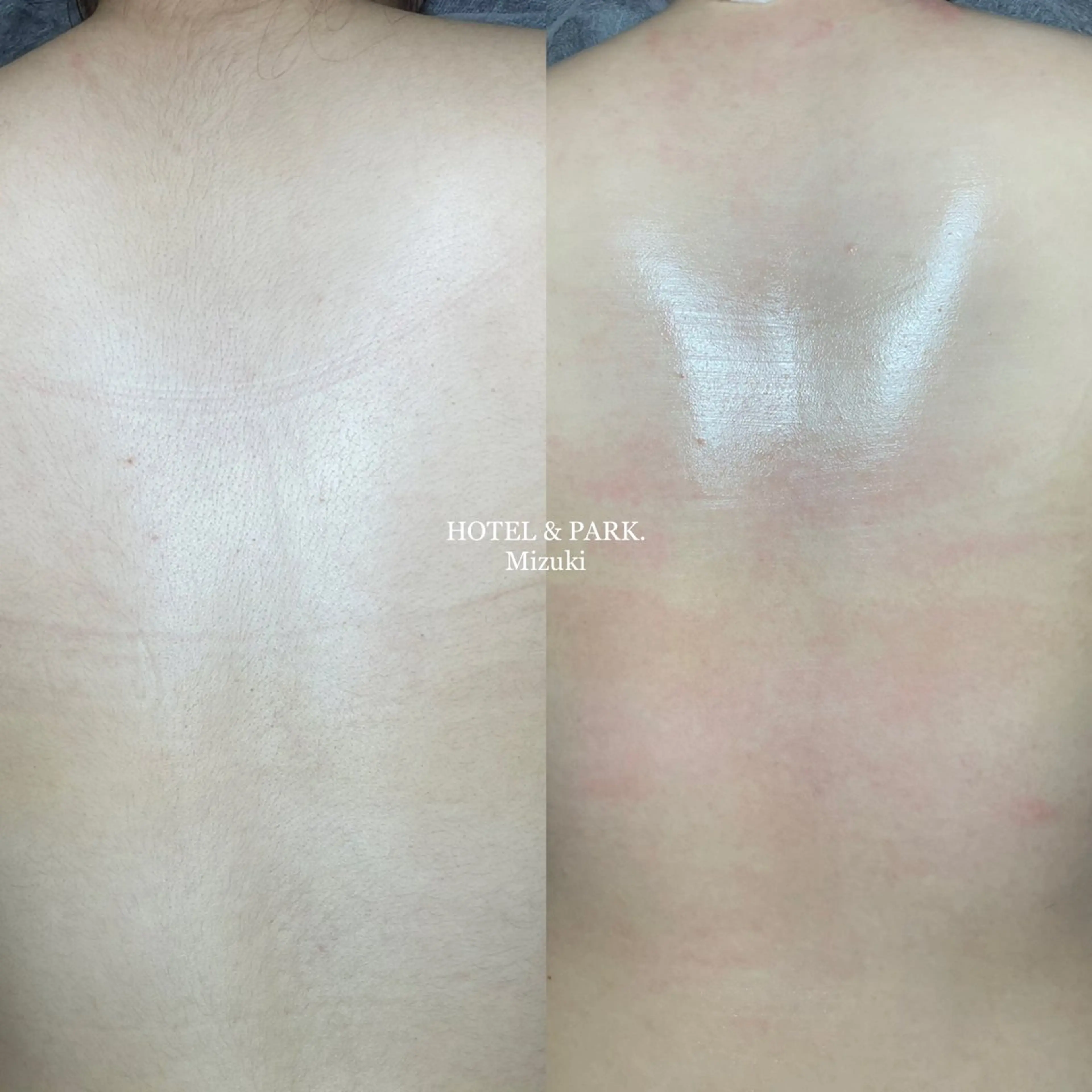 HOTEL&PARK . ワックス脱毛のエステ・リラクイメージ