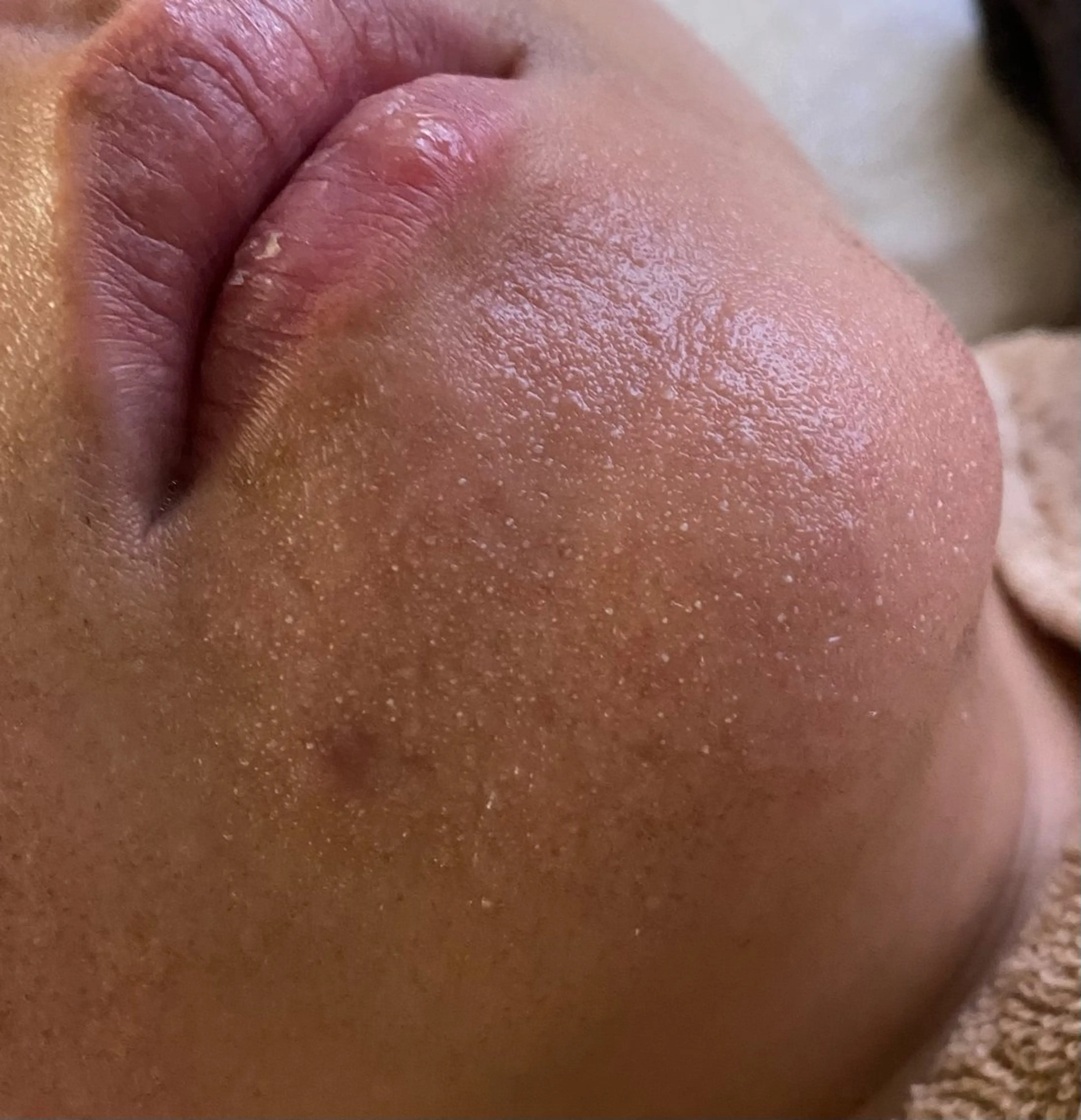 Sugaring / HILOT TAOのエステ・リラクイメージ