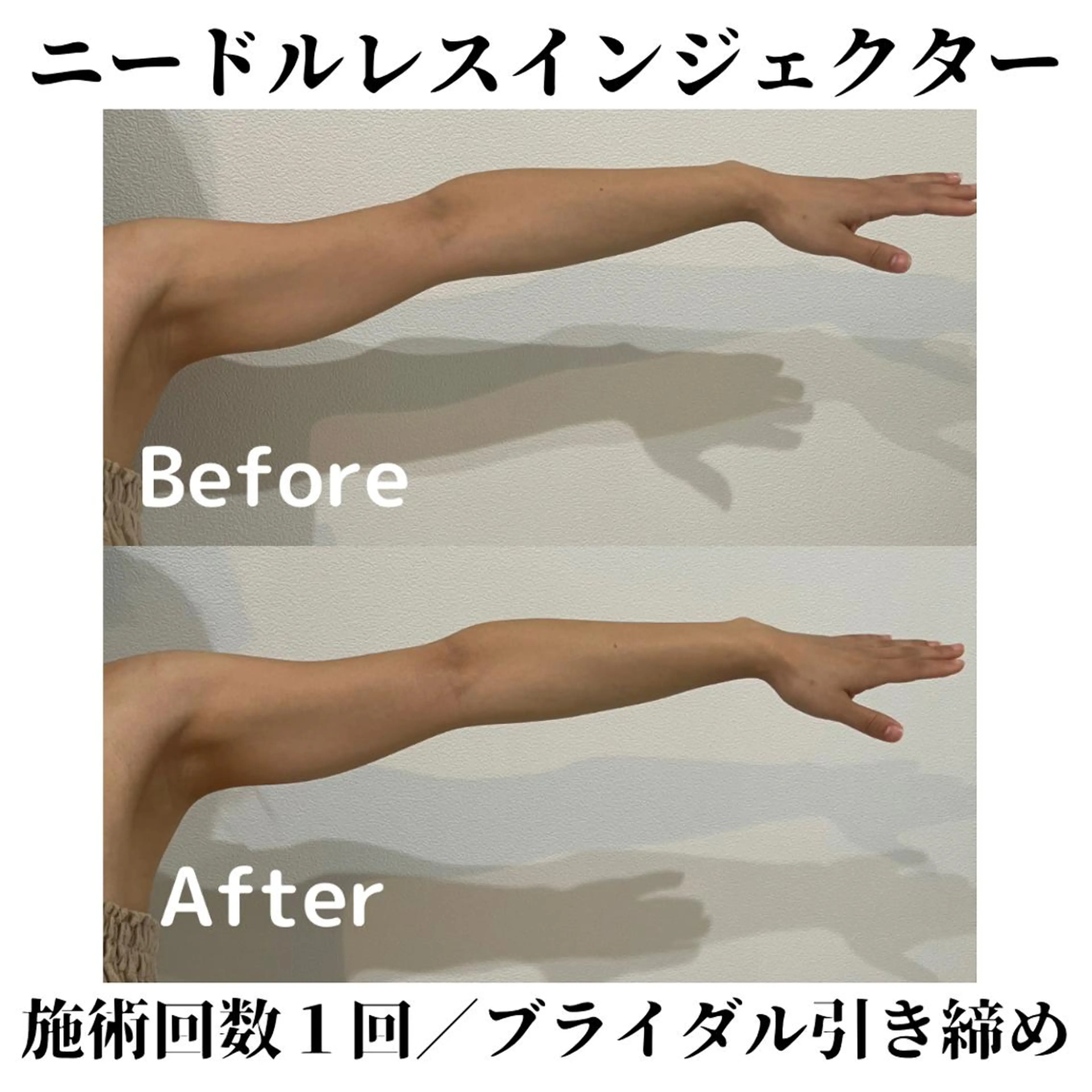 トータルビューティー サロンSalaのマツエク・マツパデザイン