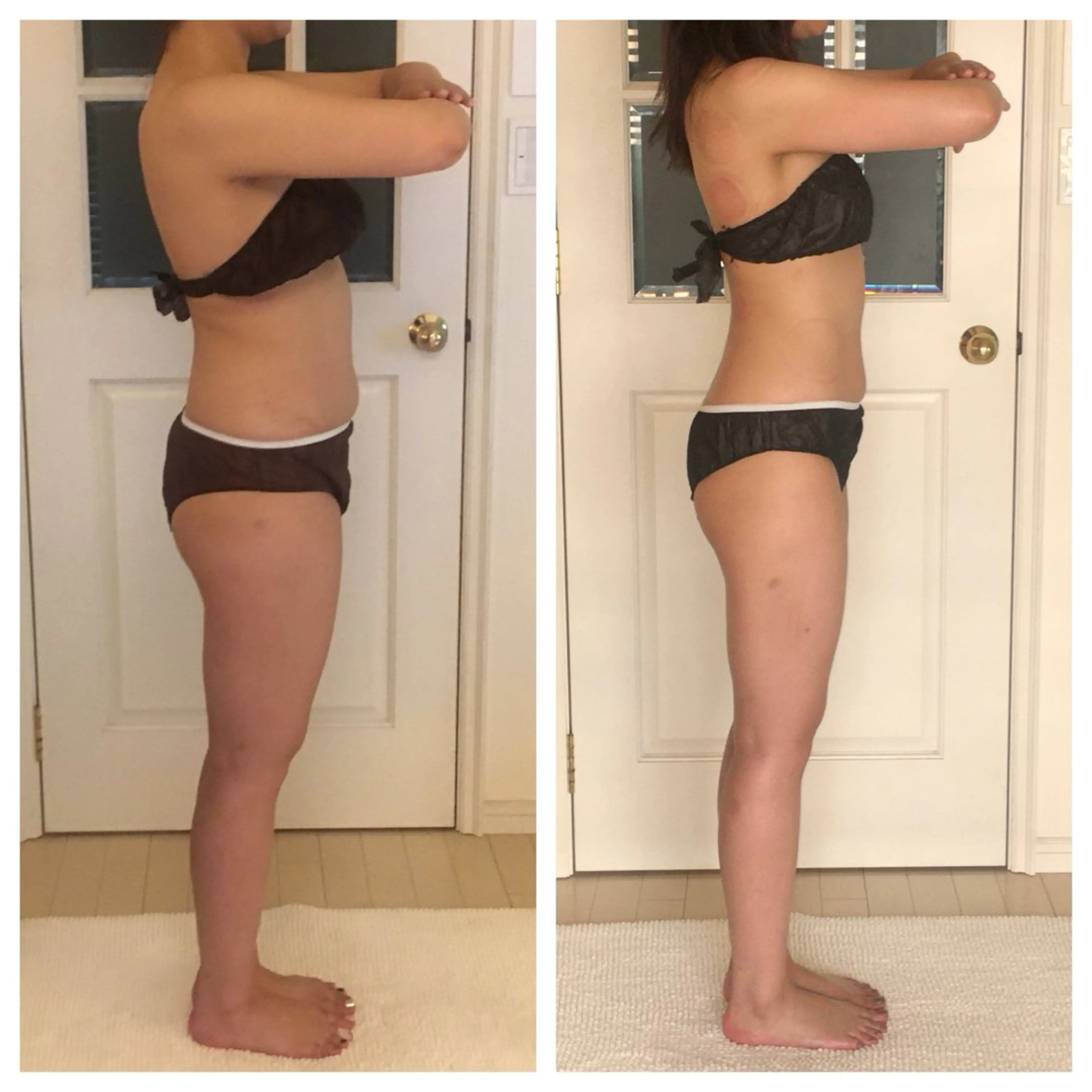 超ド級痩身/ 肩こり撃退のエステ・リラクイメージ