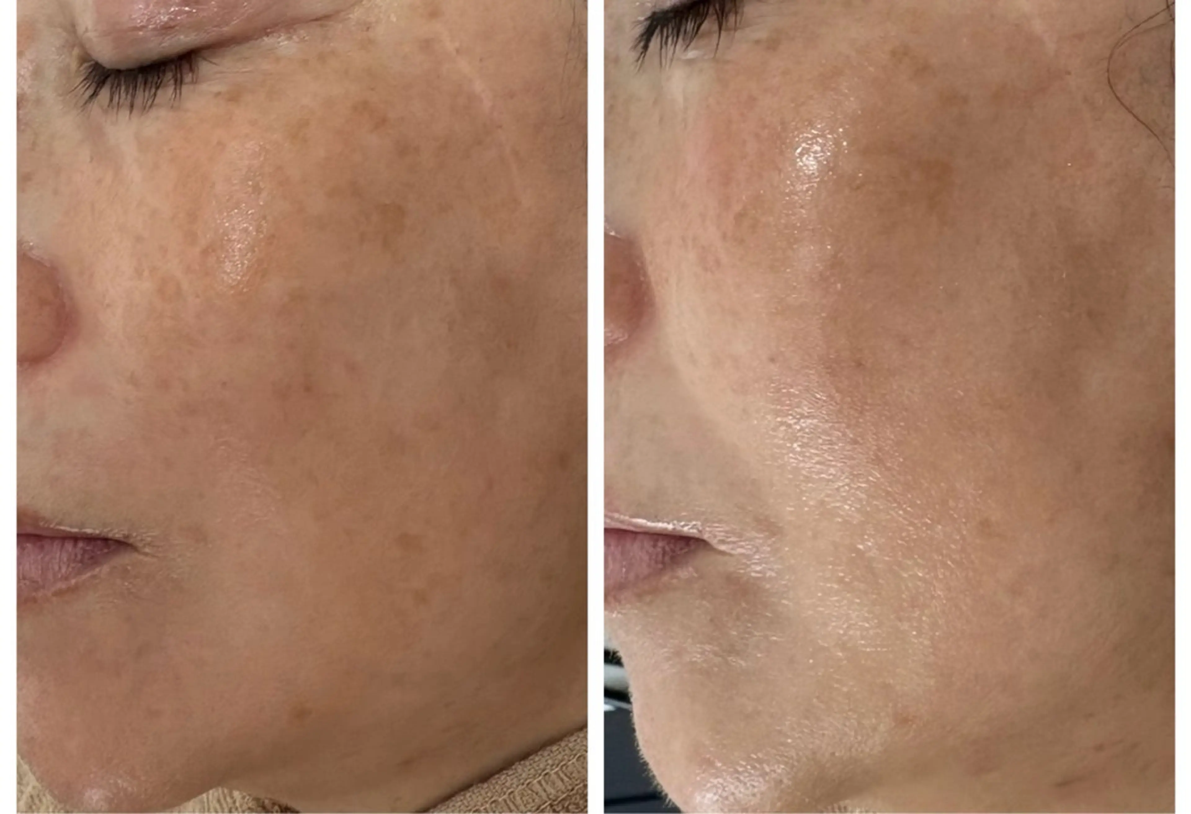 エステ Lian salonのネイルデザイン