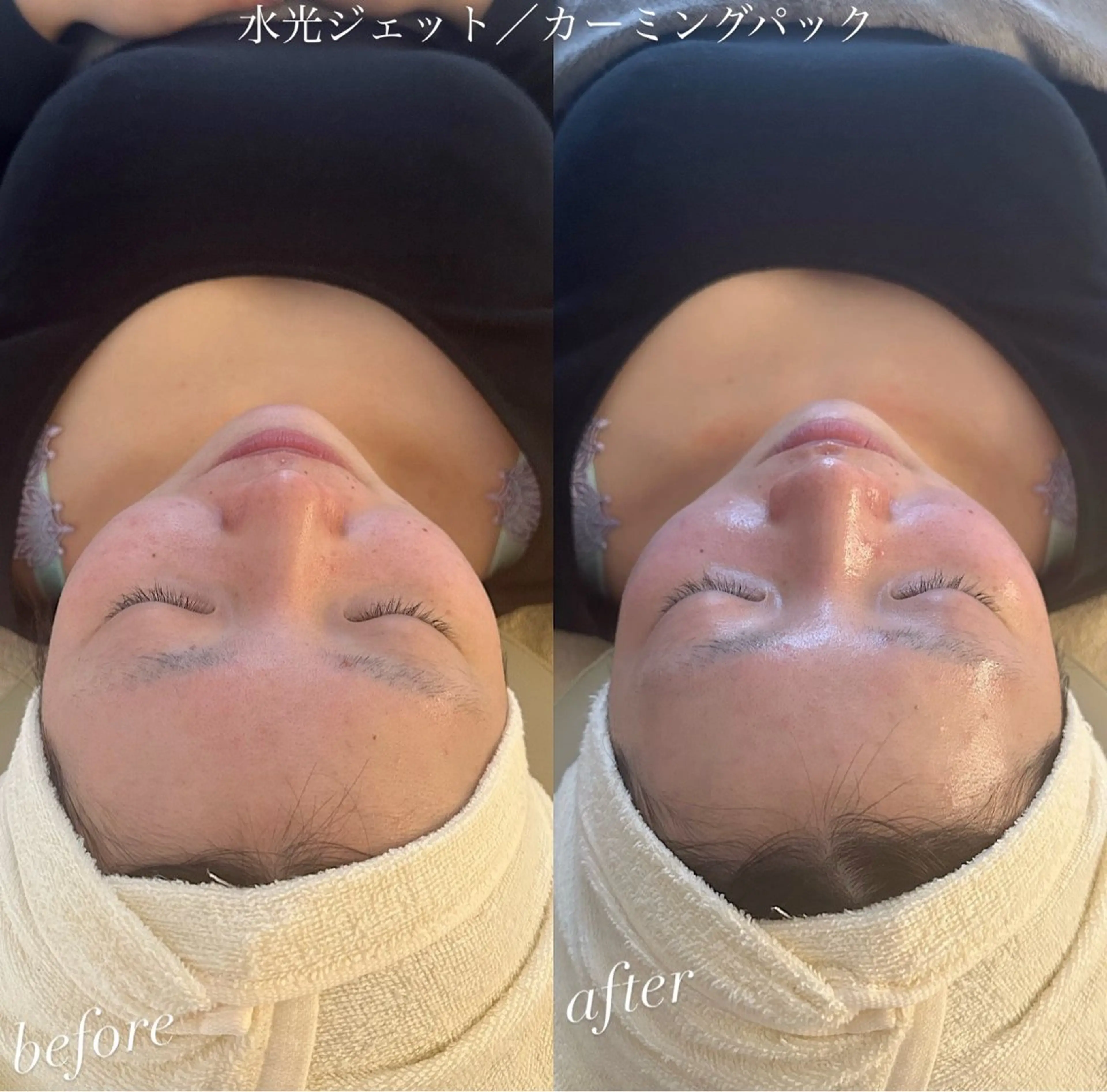 エステ うなじ脱毛/美肌脱毛 LABELのエステ・リラクイメージ