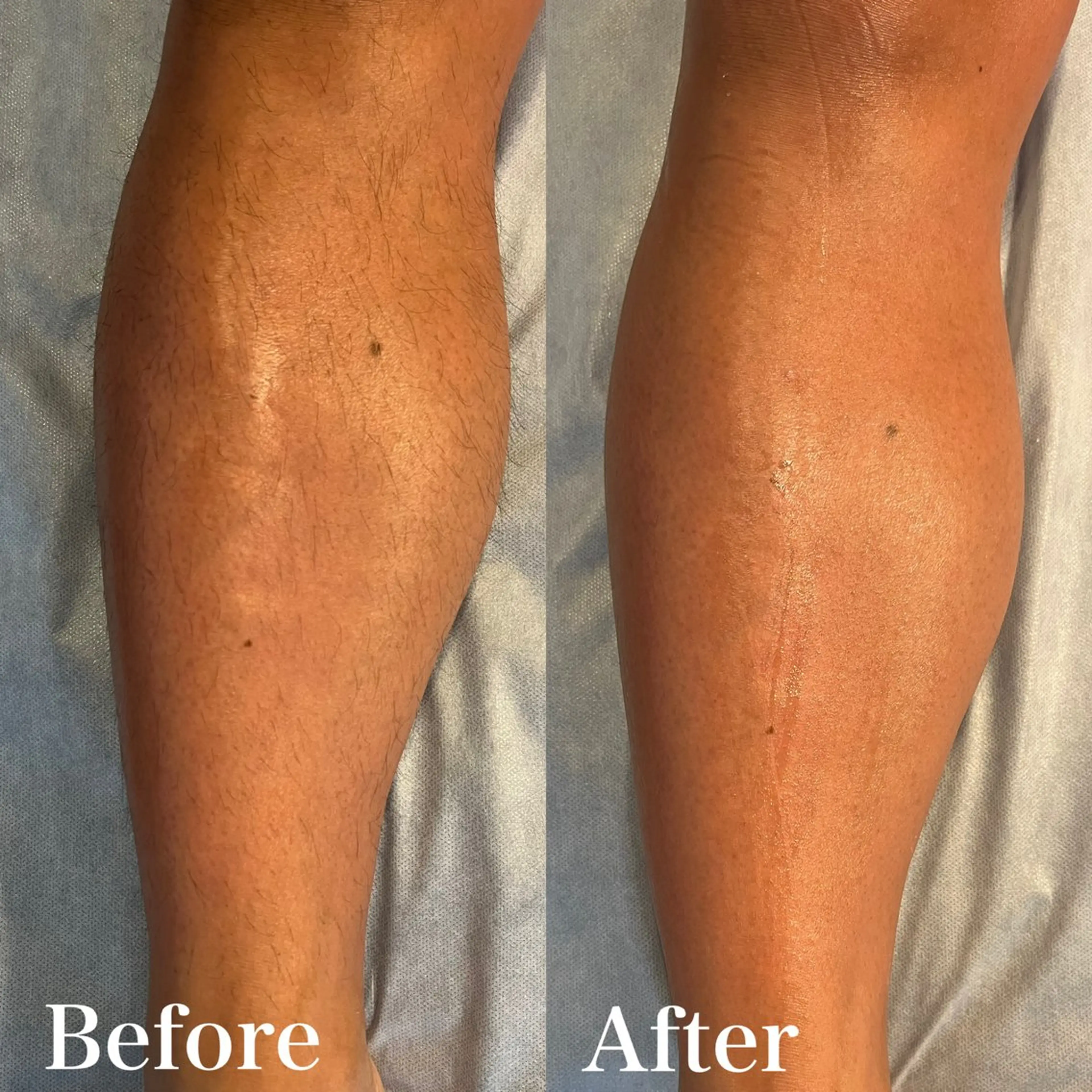 メンズ 脱毛 wax脱毛専門店 ハイラントのエステ・リラクイメージ